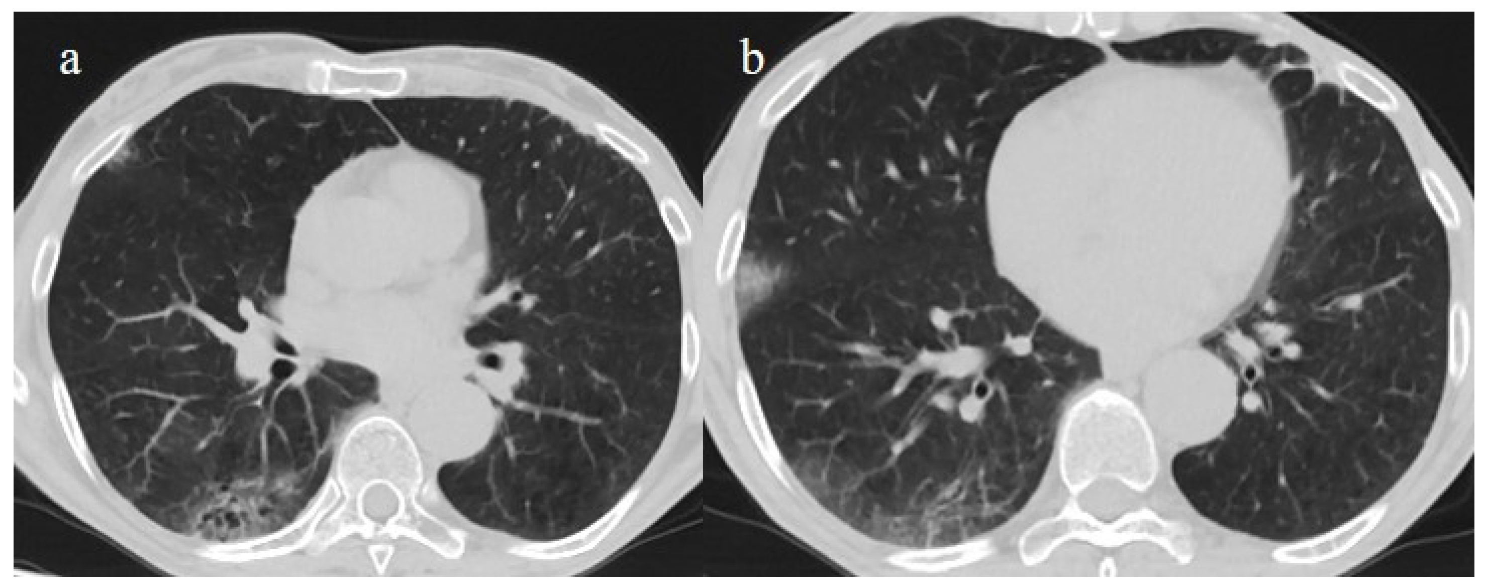 Biomedicines 11 02113 g010