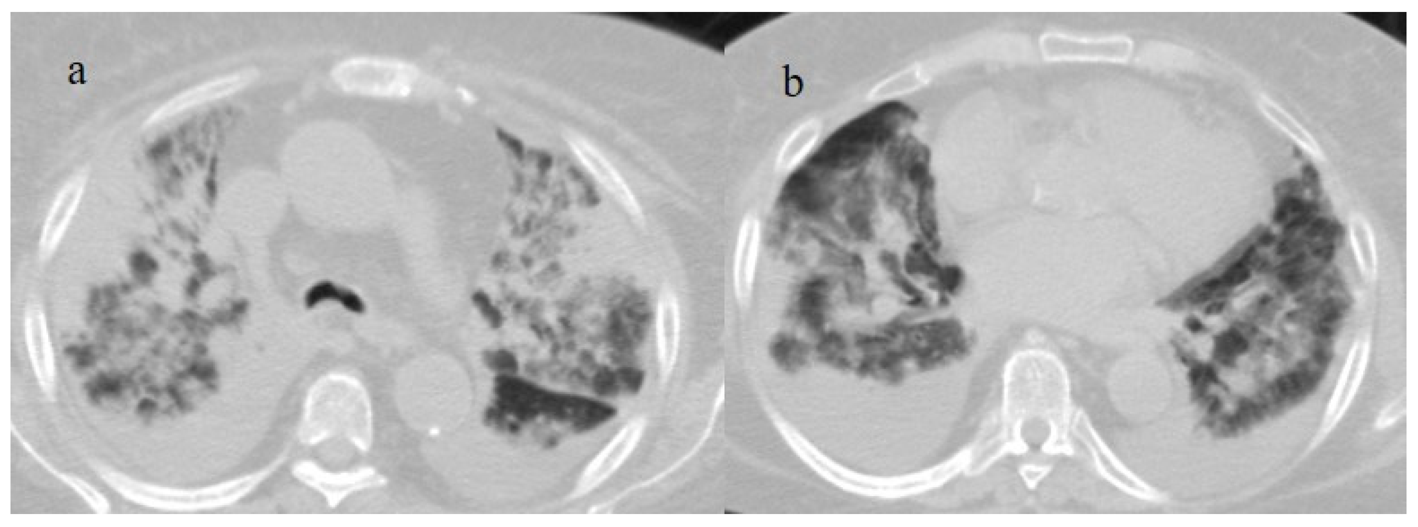 Biomedicines 11 02113 g012