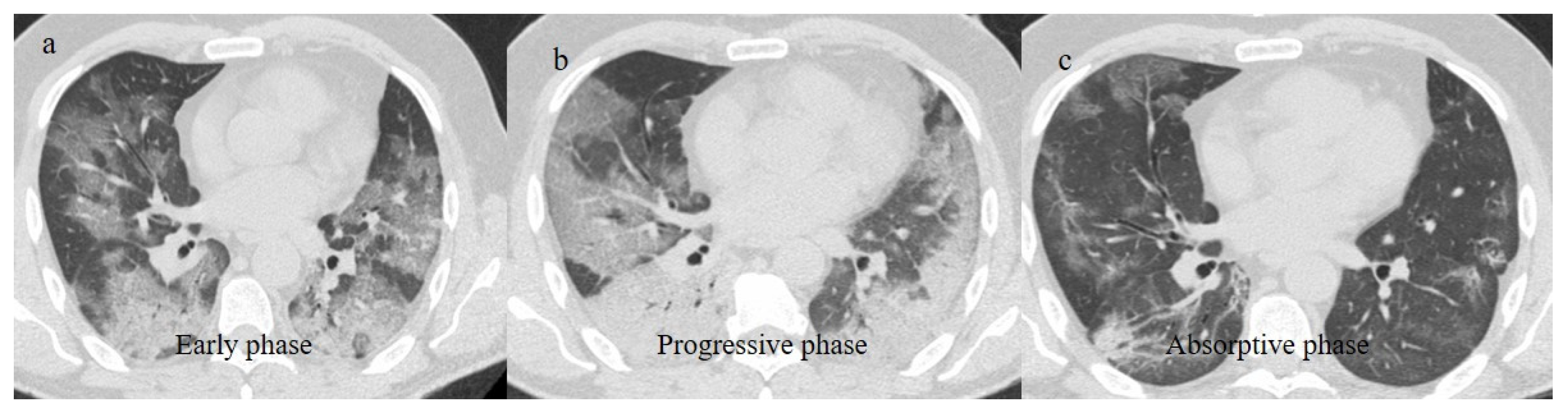 Biomedicines 11 02113 g013