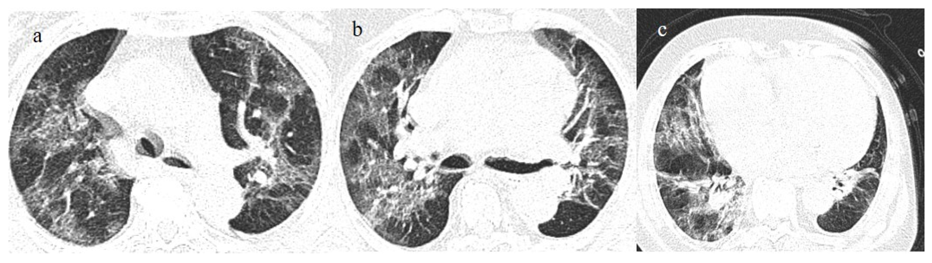 Biomedicines 11 02113 g014