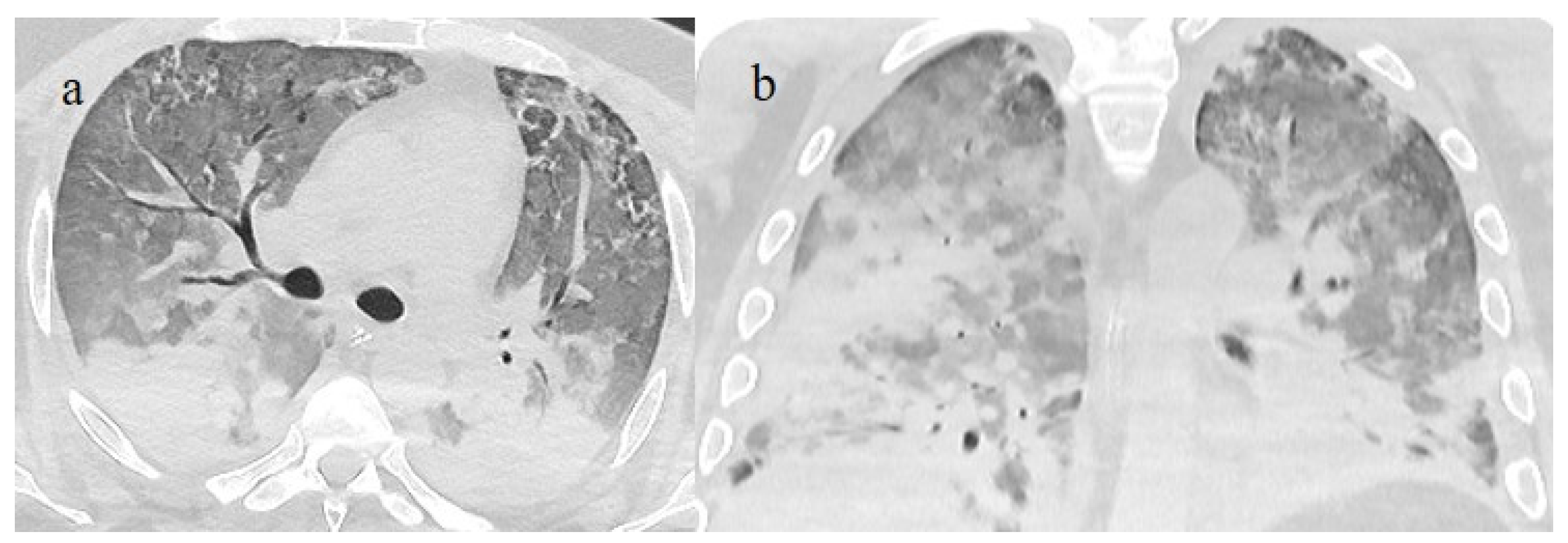 Biomedicines 11 02113 g015