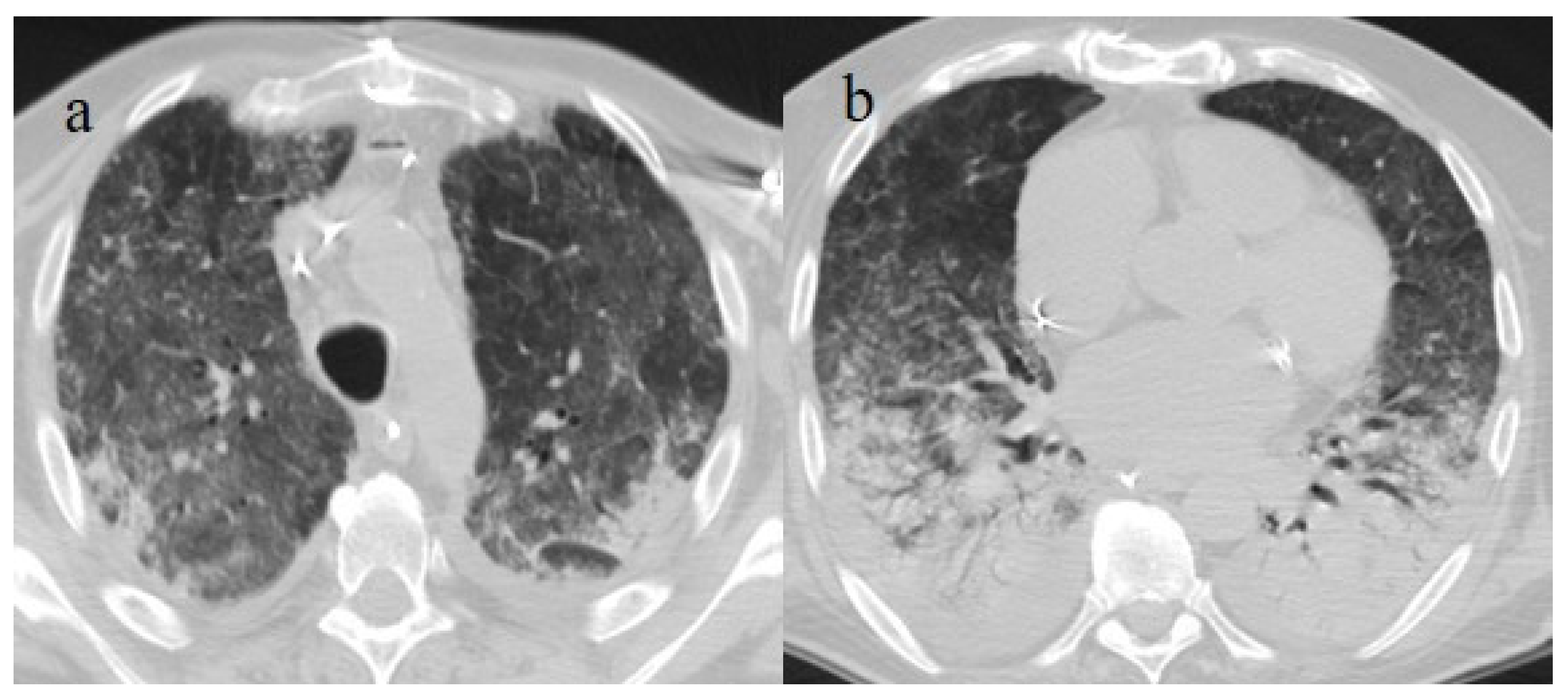 Biomedicines 11 02113 g016