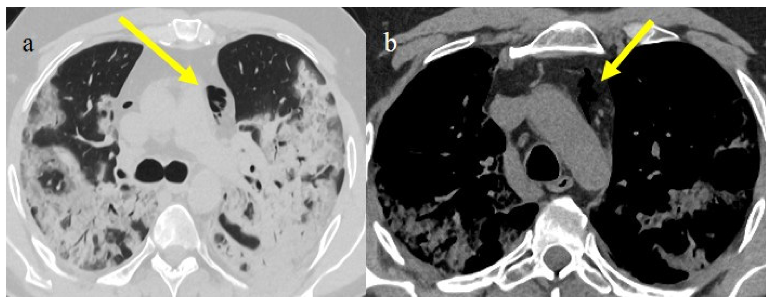 Biomedicines 11 02113 g018