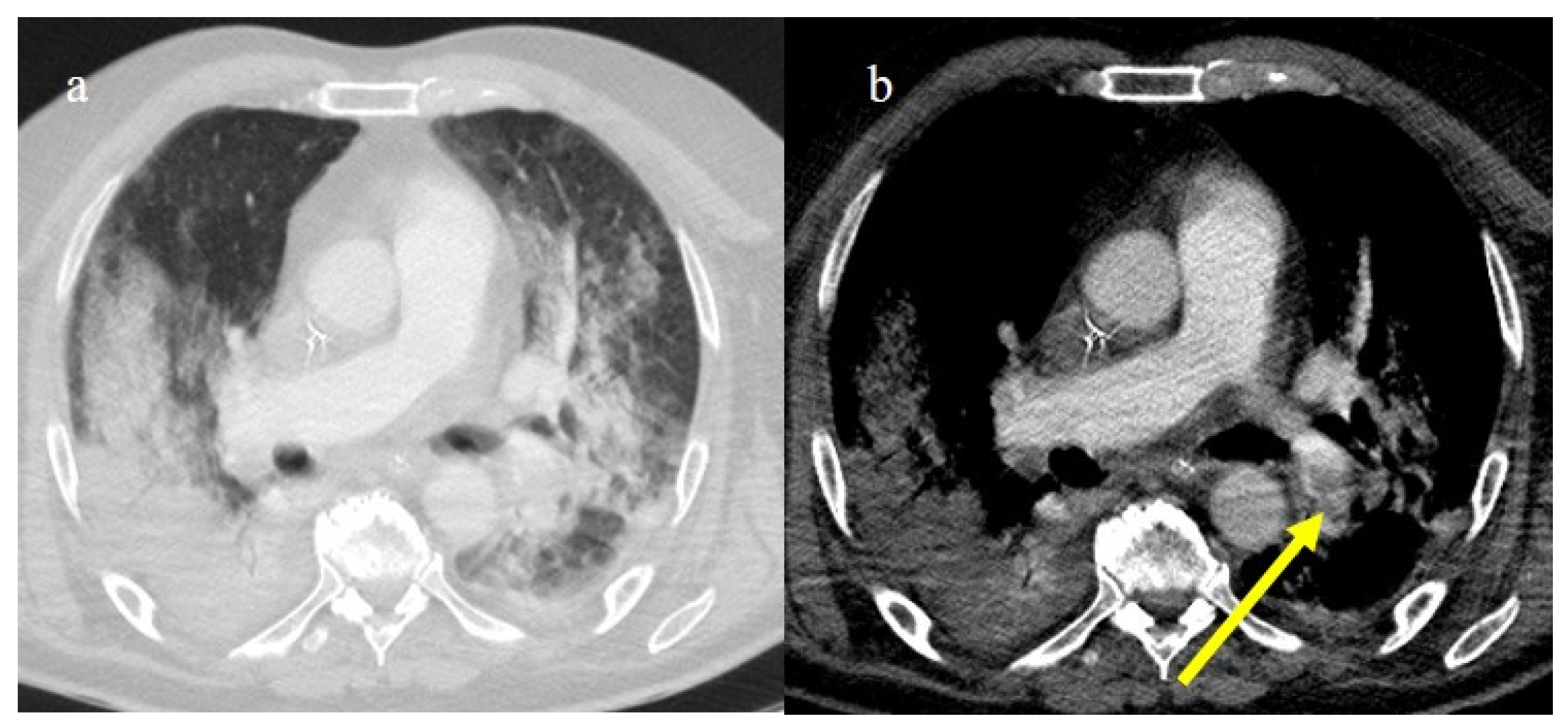 Biomedicines 11 02113 g021