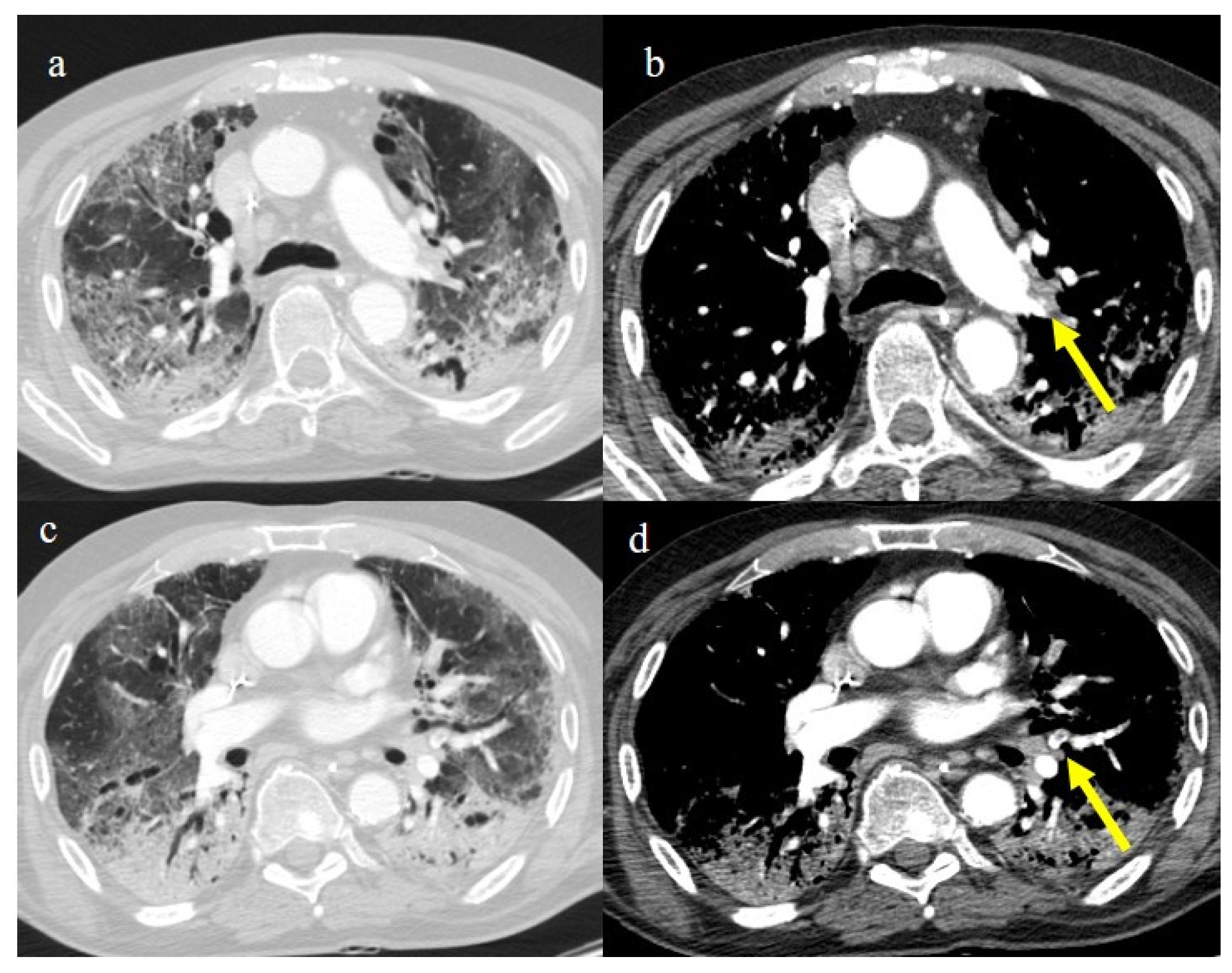 Biomedicines 11 02113 g022