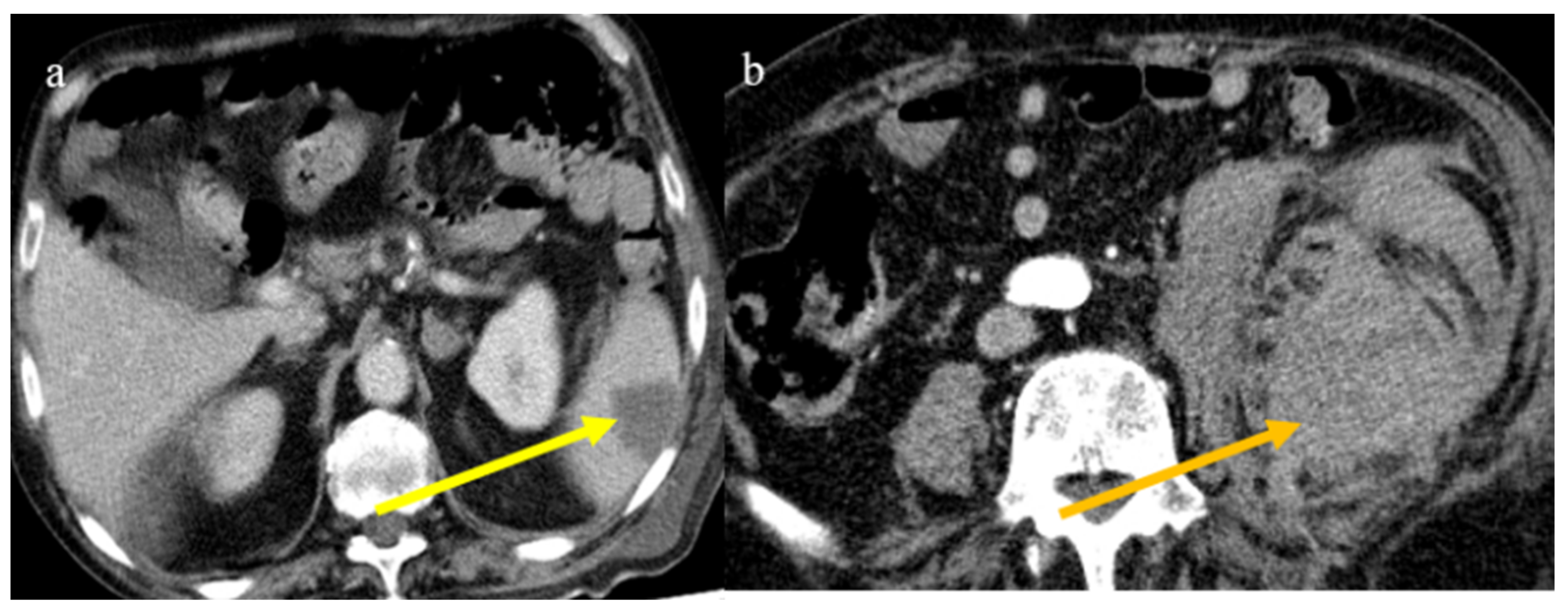 Biomedicines 11 02113 g025
