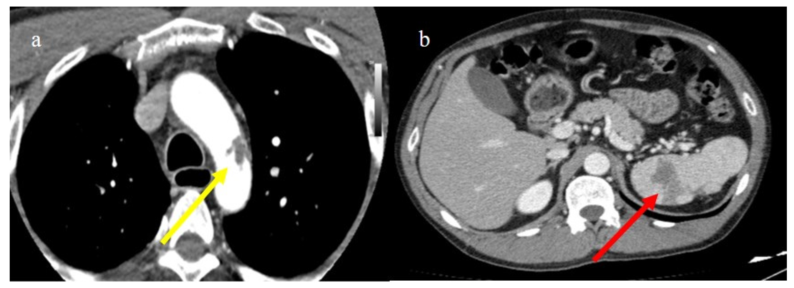 Biomedicines 11 02113 g026