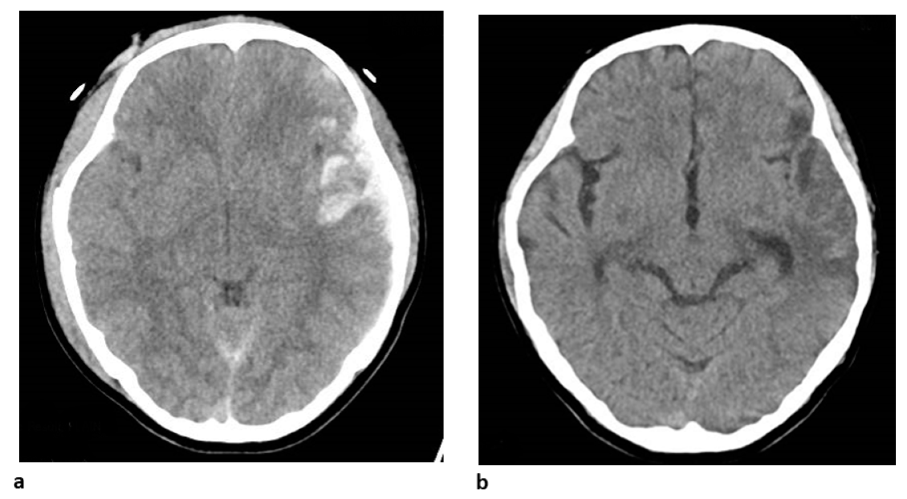 Biomedicines 11 02129 g007