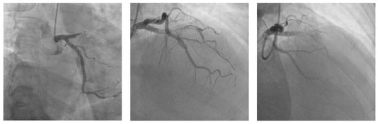Biomedicines 11 02255 g003a Biomedicines 11 02255 g003a