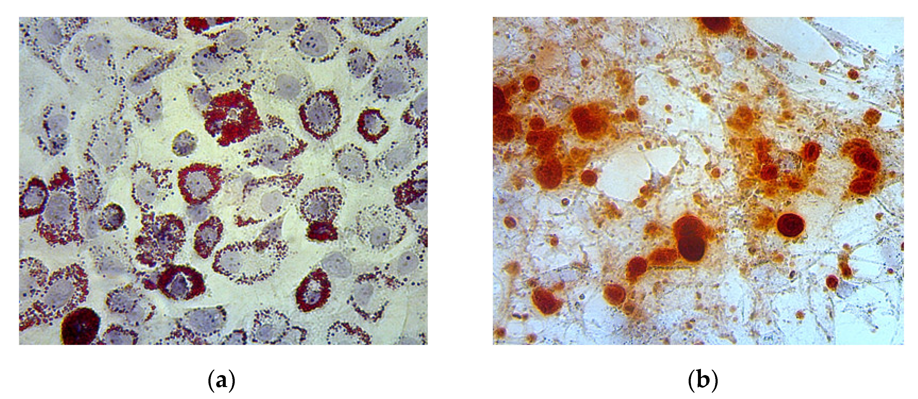 Biomedicines 11 02325 g003 Biomedicines 11 02325 g003