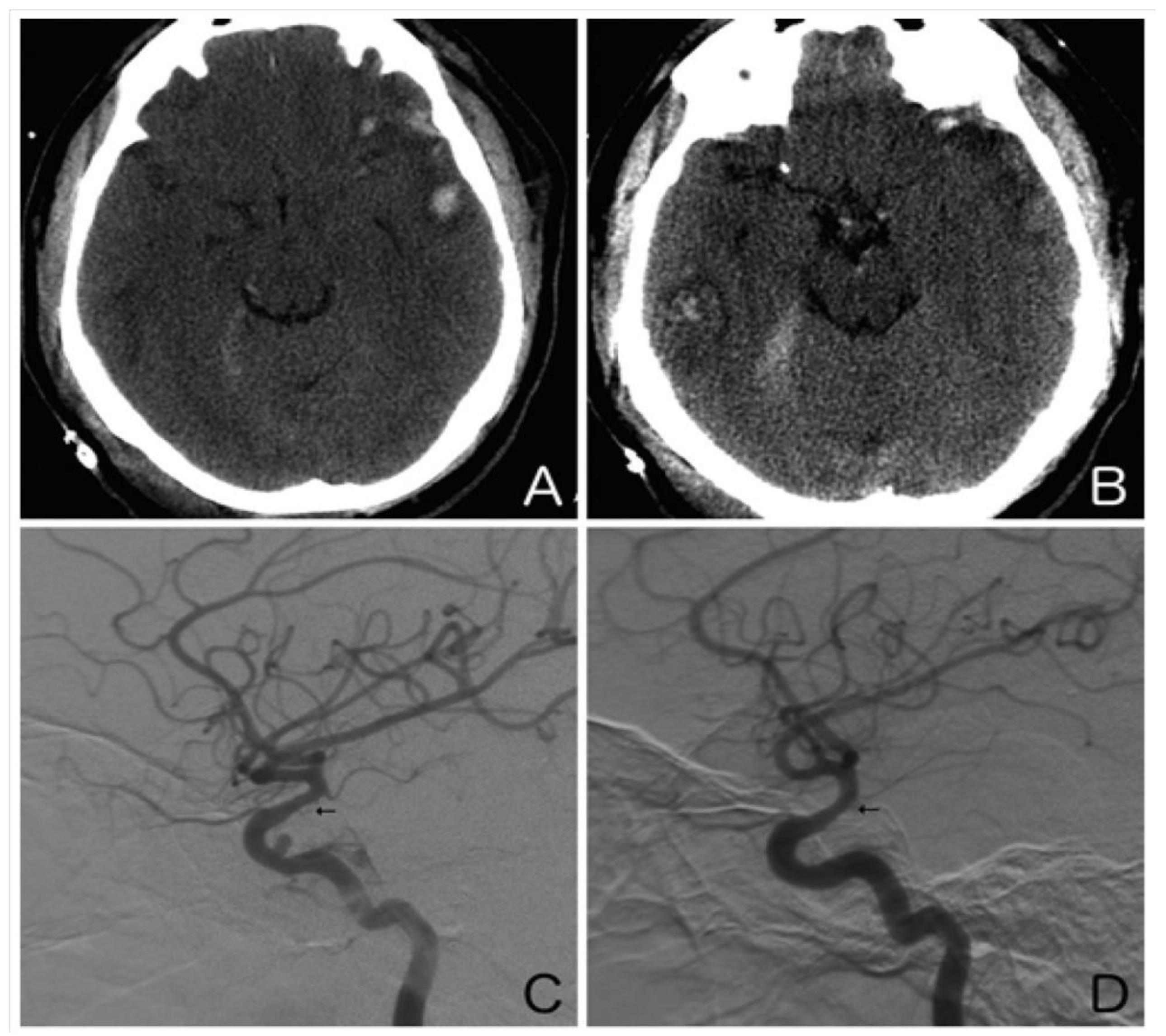 Biomedicines 11 02409 g002 Biomedicines 11 02409 g002