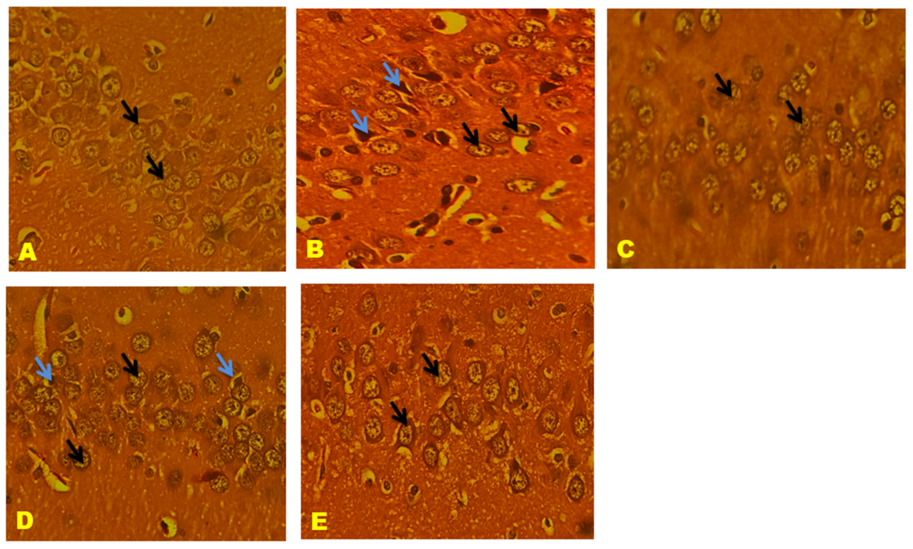 Biomedicines 11 02756 g017