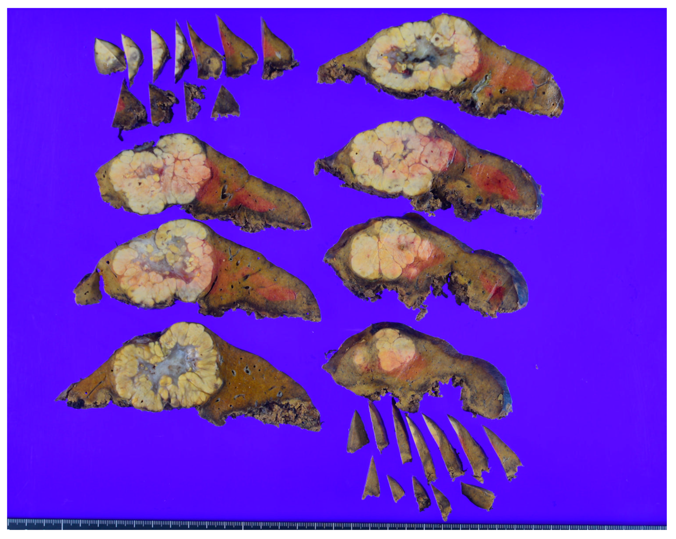 Biomedicines 11 02761 g001 Biomedicines 11 02761 g001