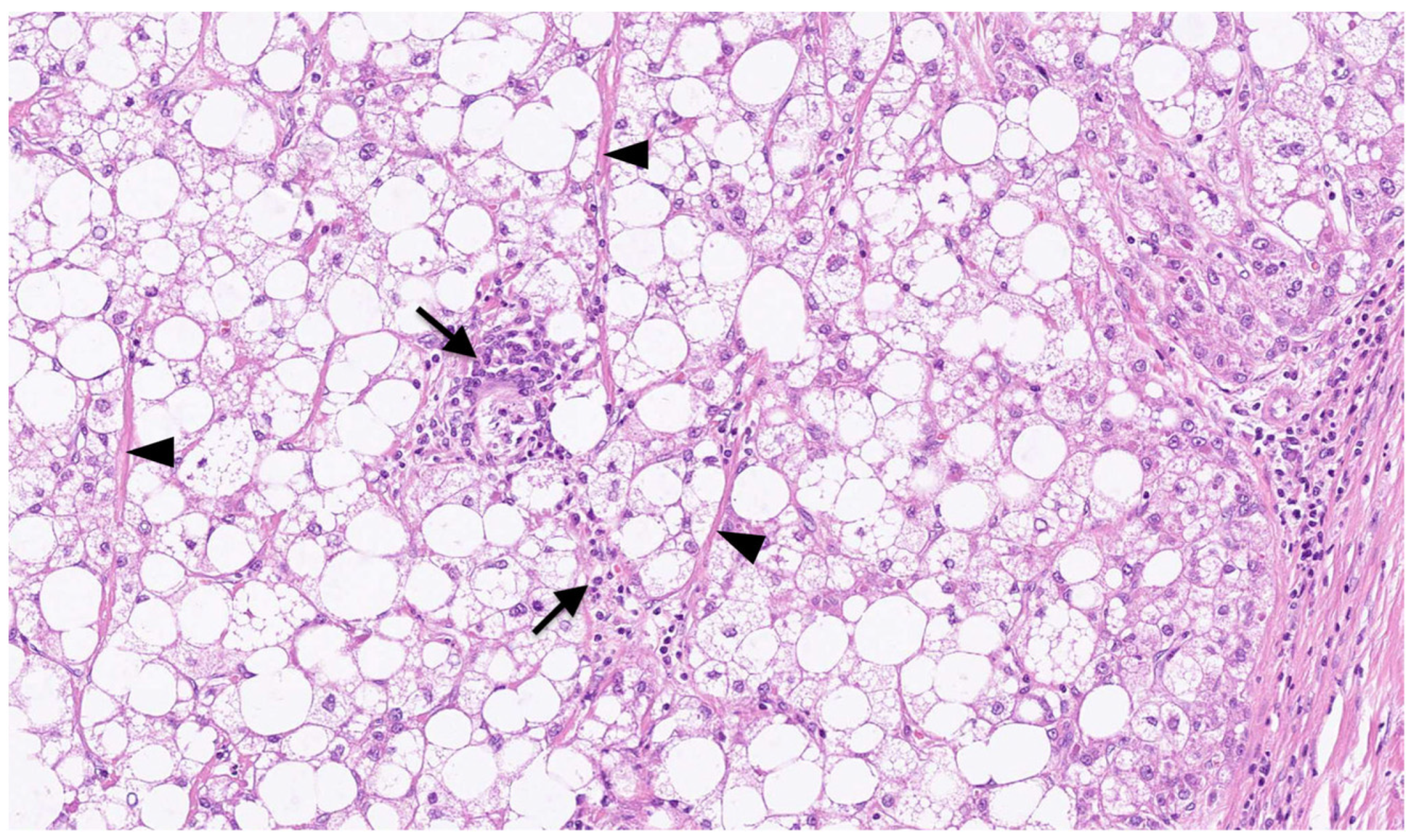 Biomedicines 11 02761 g002 Biomedicines 11 02761 g002