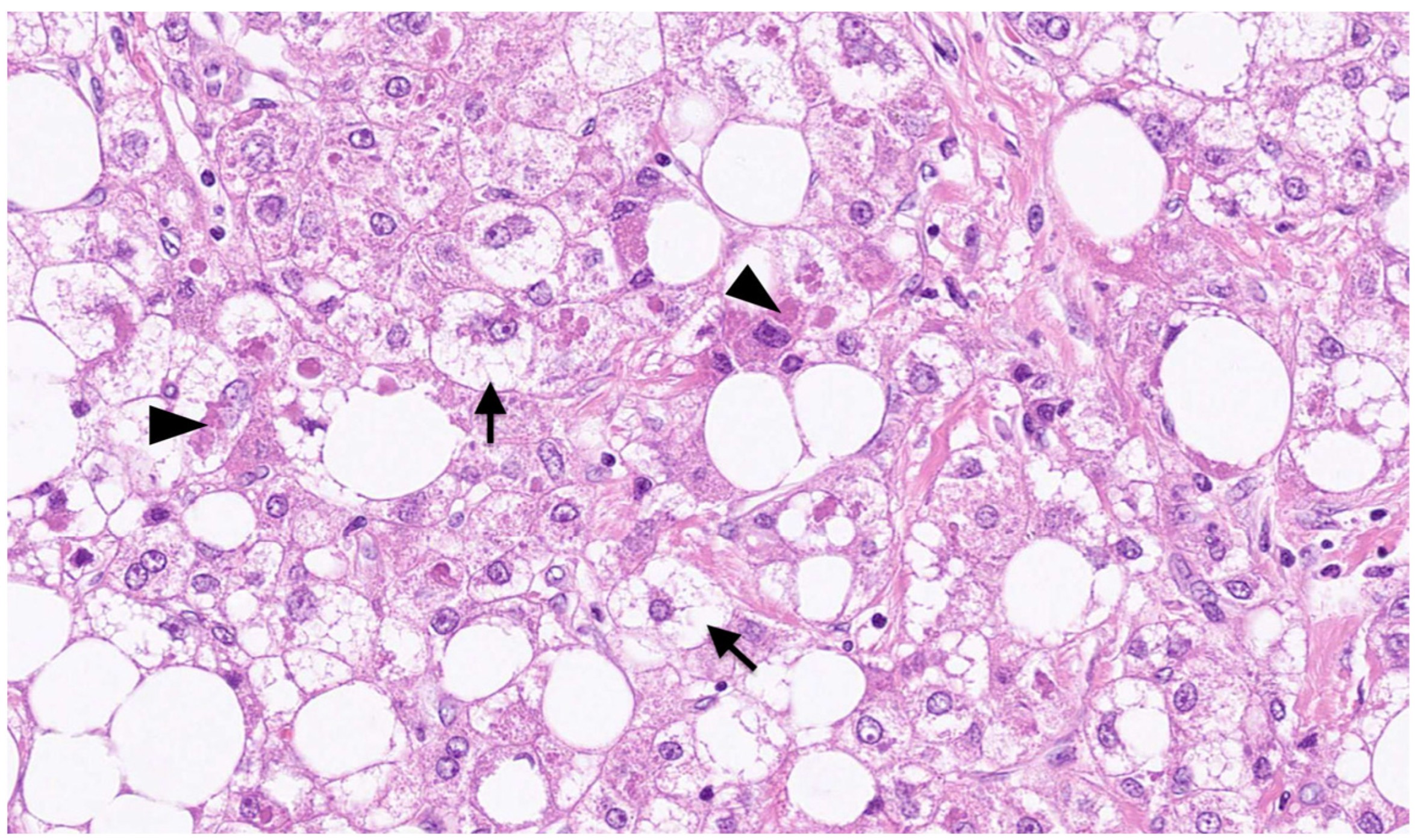 Biomedicines 11 02761 g003 Biomedicines 11 02761 g003
