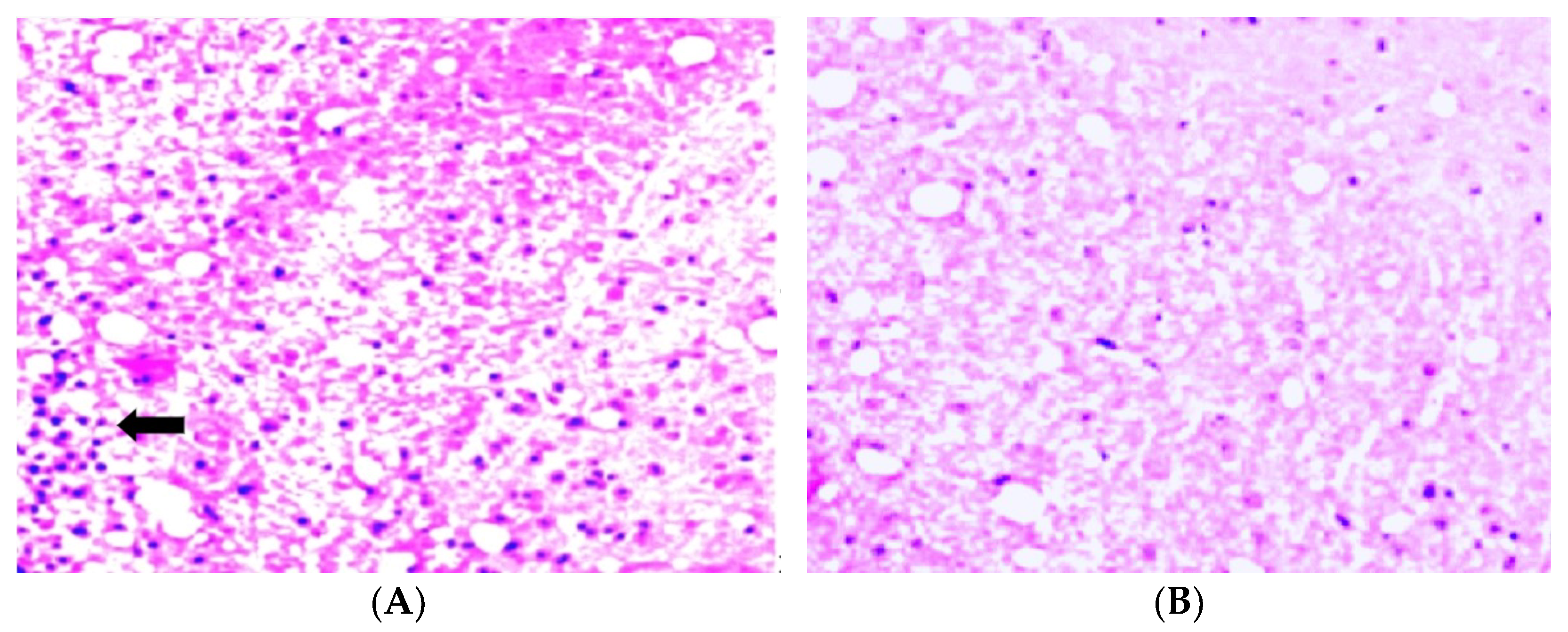 Biomedicines 11 02855 g006 Biomedicines 11 02855 g006