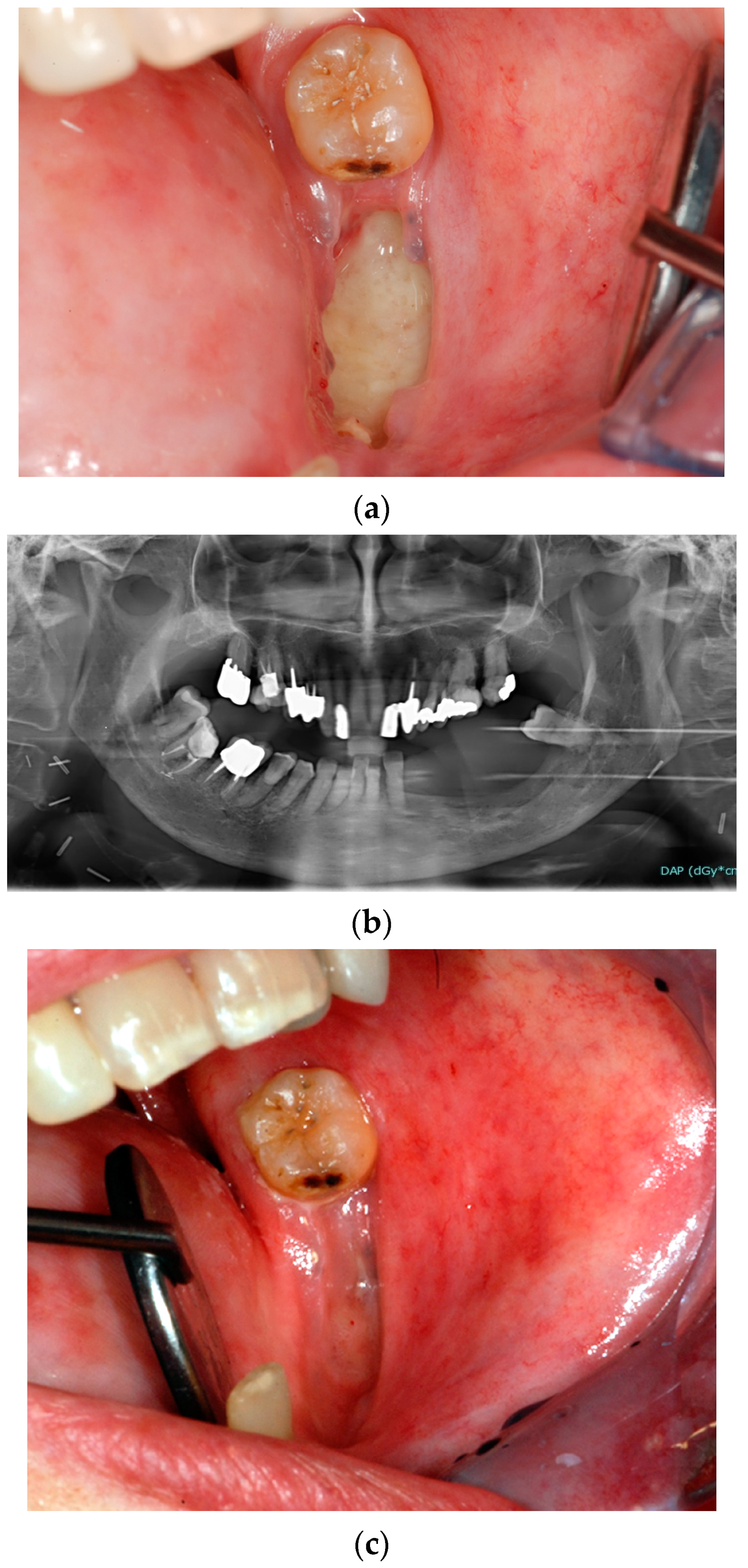 Biomedicines 11 03339 g001