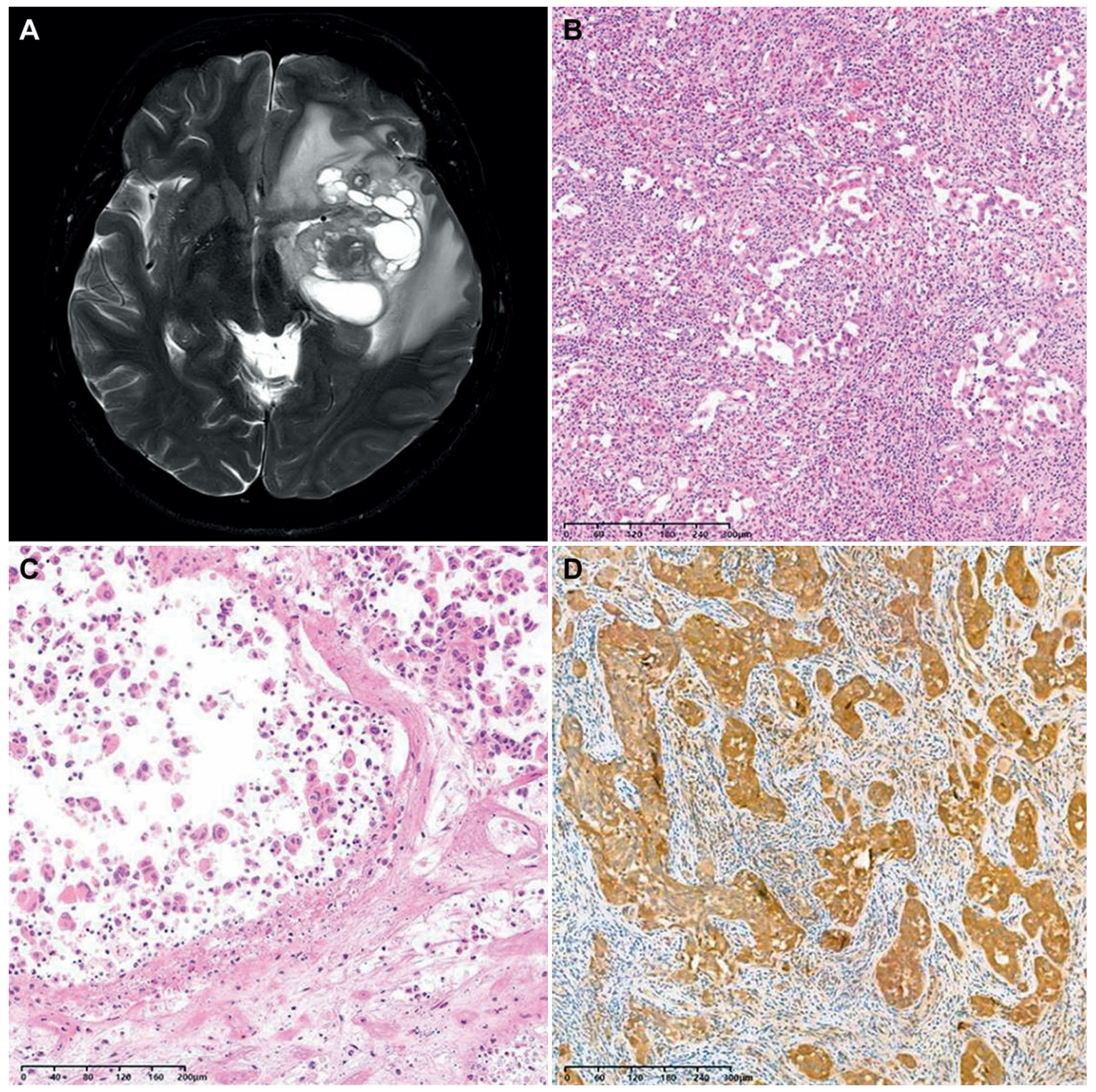 Biomedicines 12 00150 g004