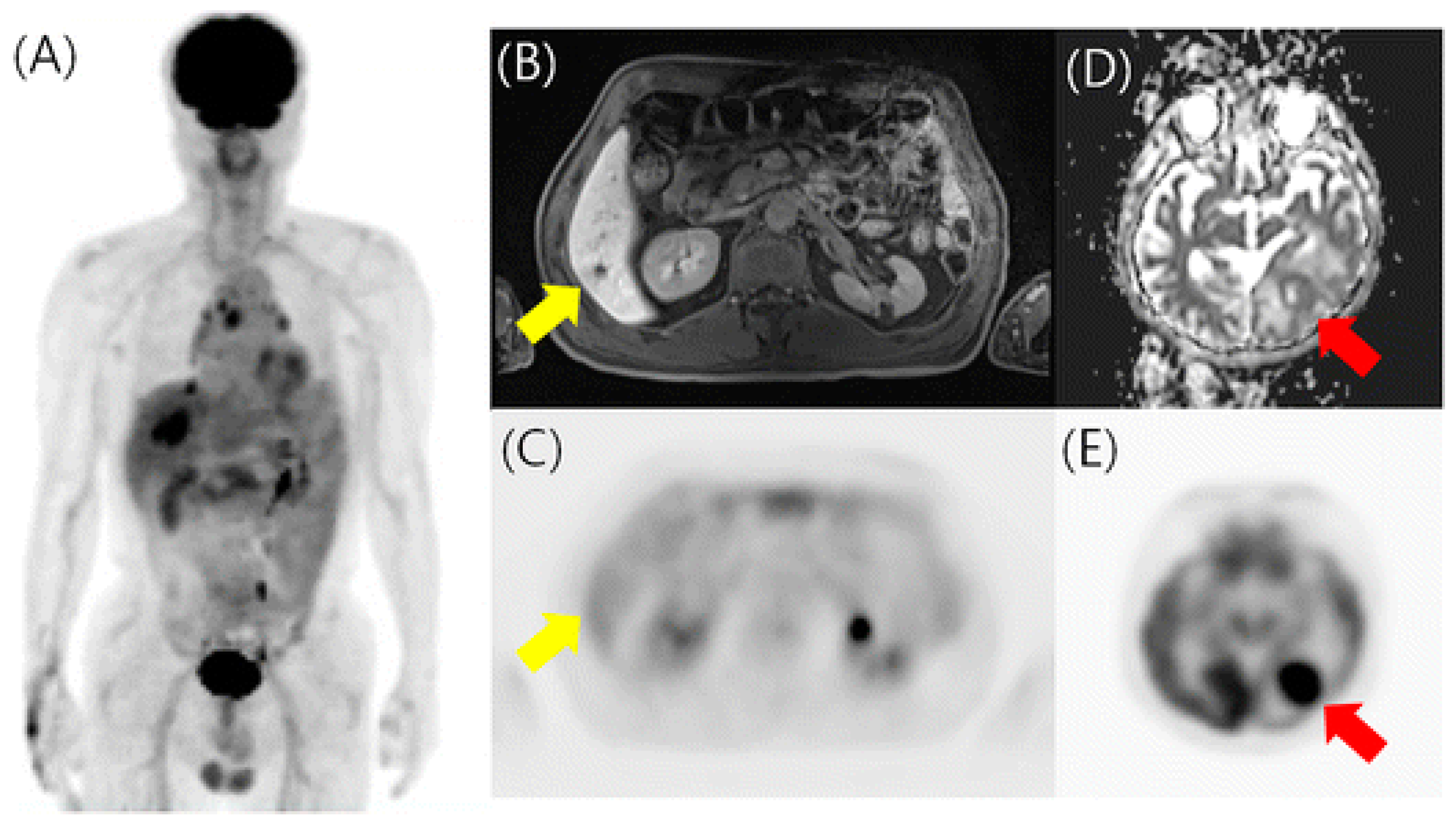 Biomedicines 12 00172 g004