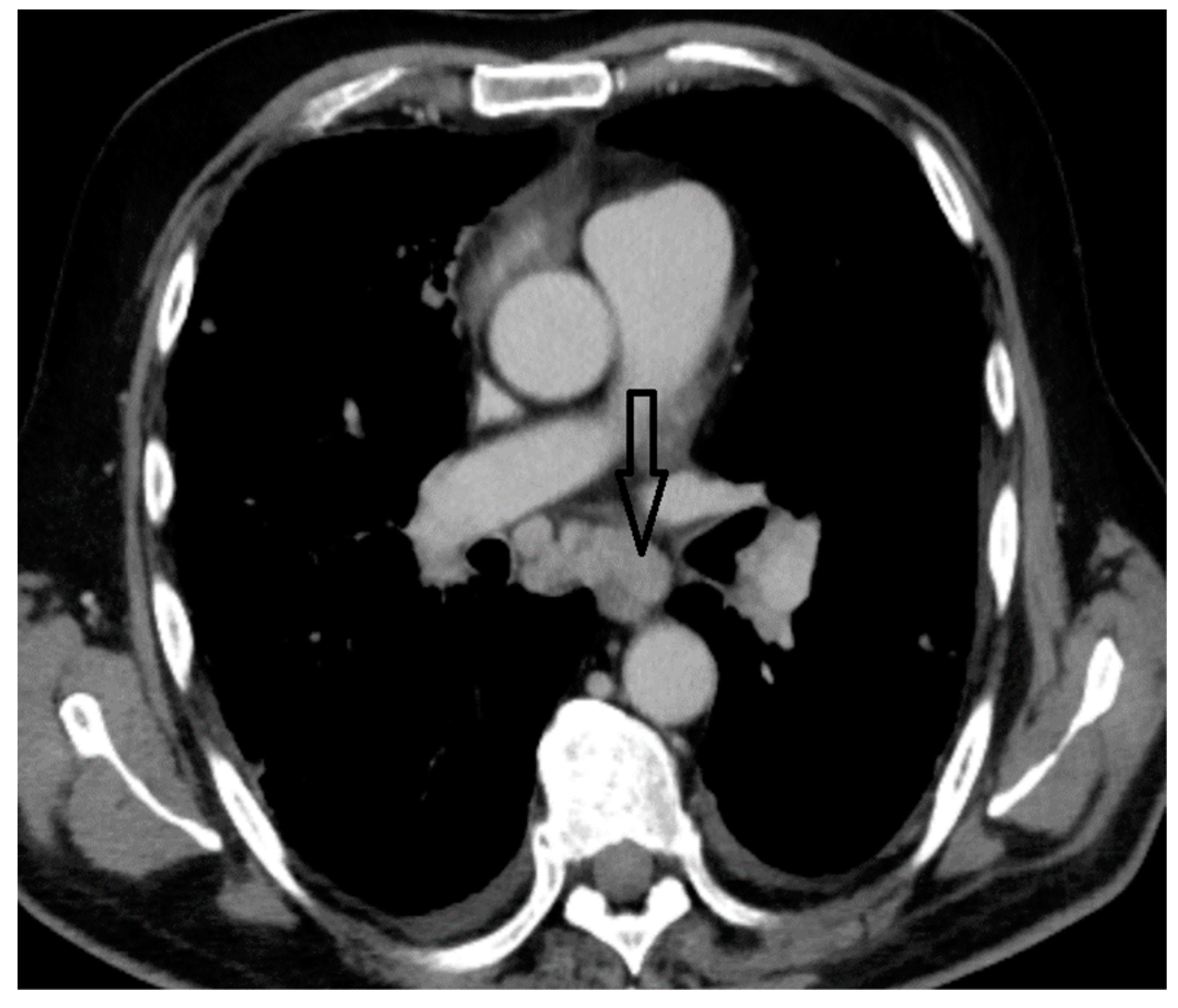 Biomedicines 12 00285 g004 Biomedicines 12 00285 g004