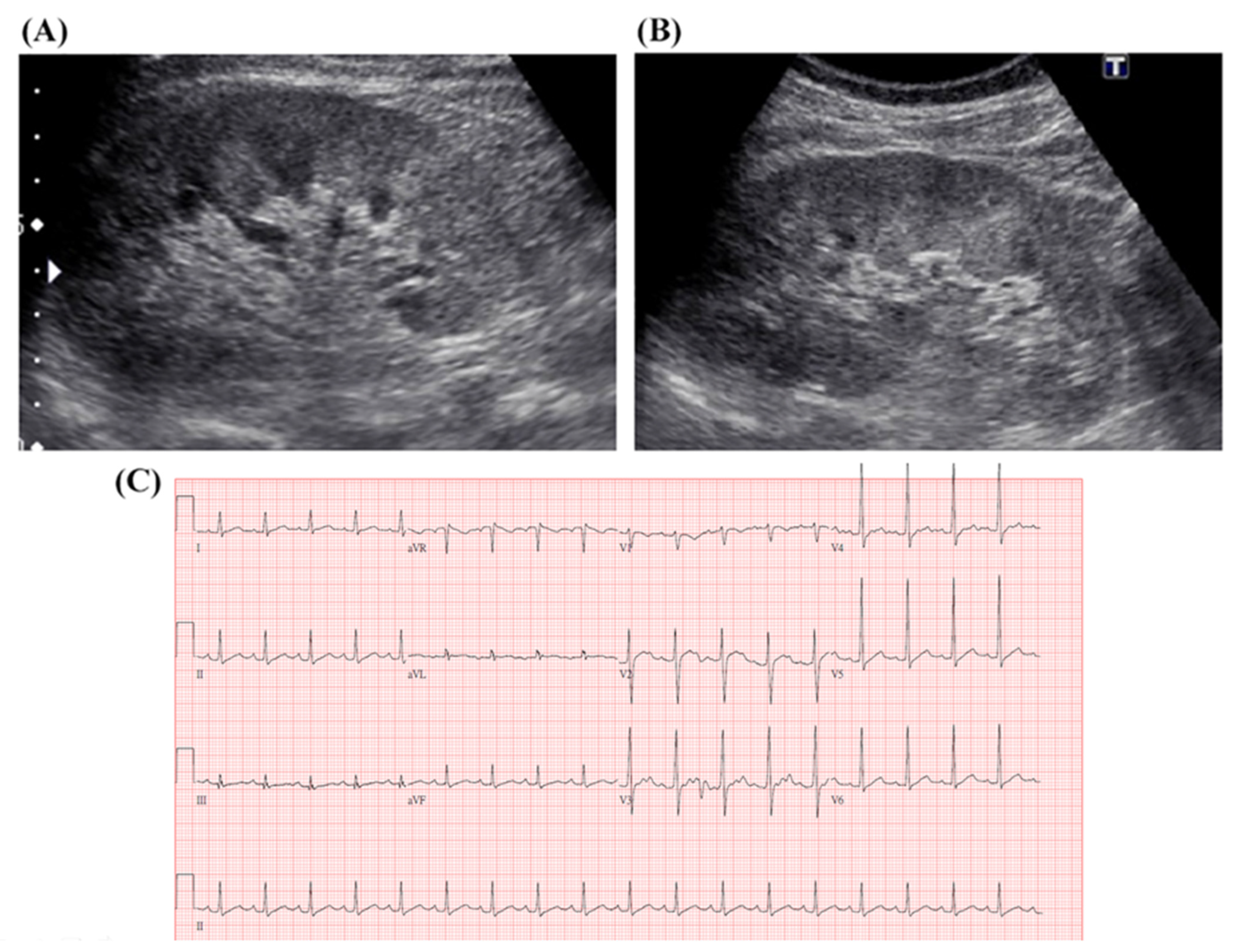 Biomedicines 12 00435 g003