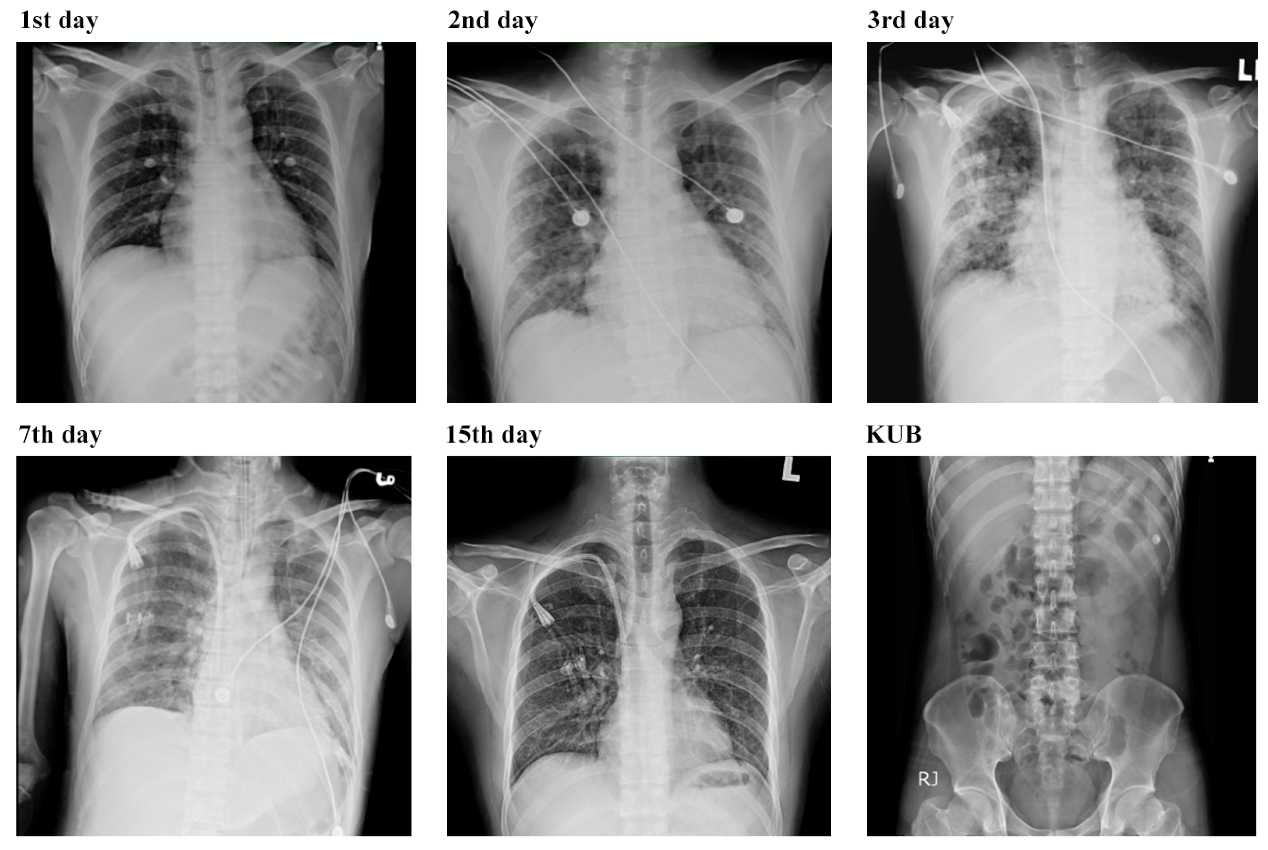 Biomedicines 12 00435 g004