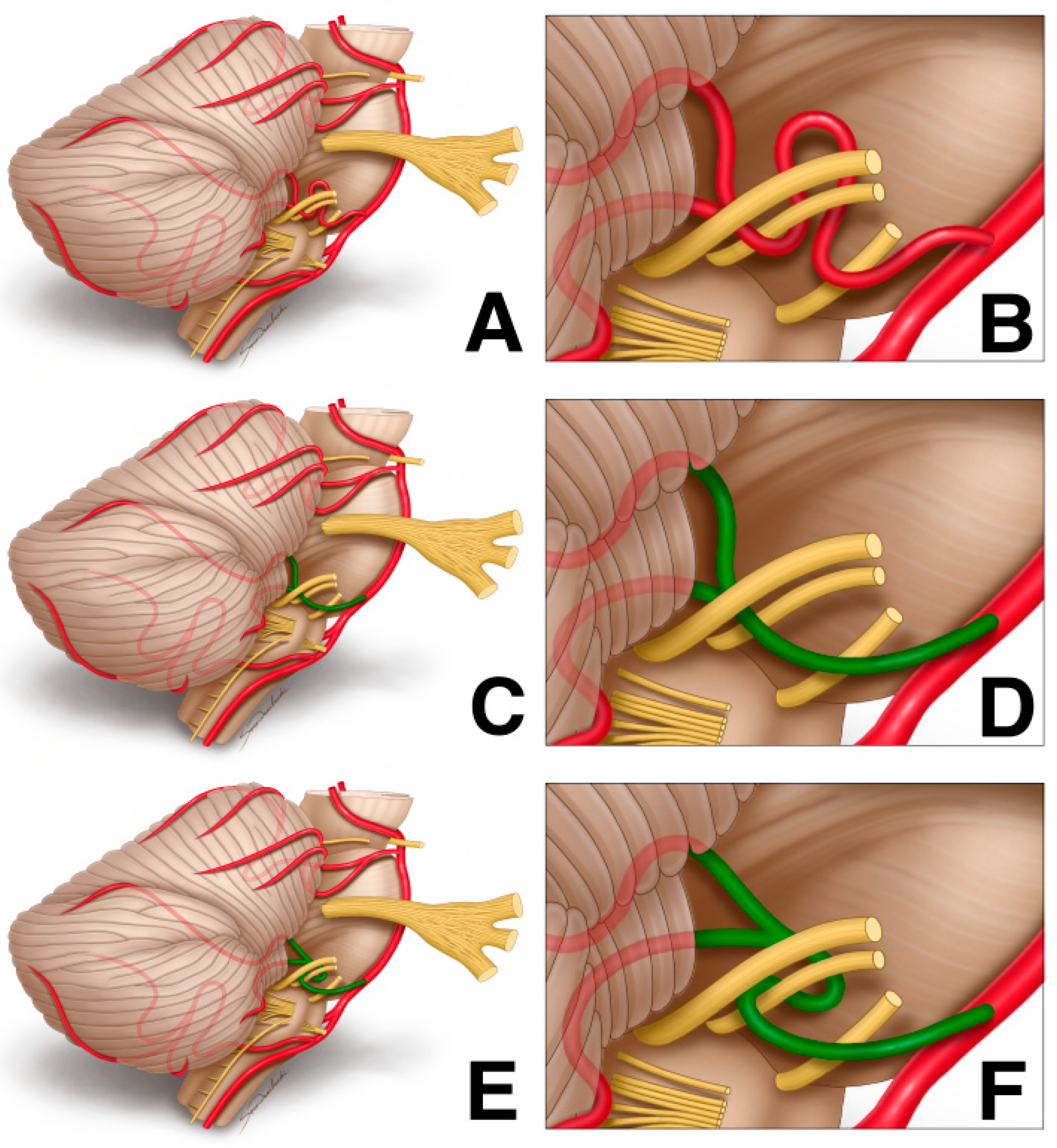 Biomedicines 12 00452 g002 Biomedicines 12 00452 g002