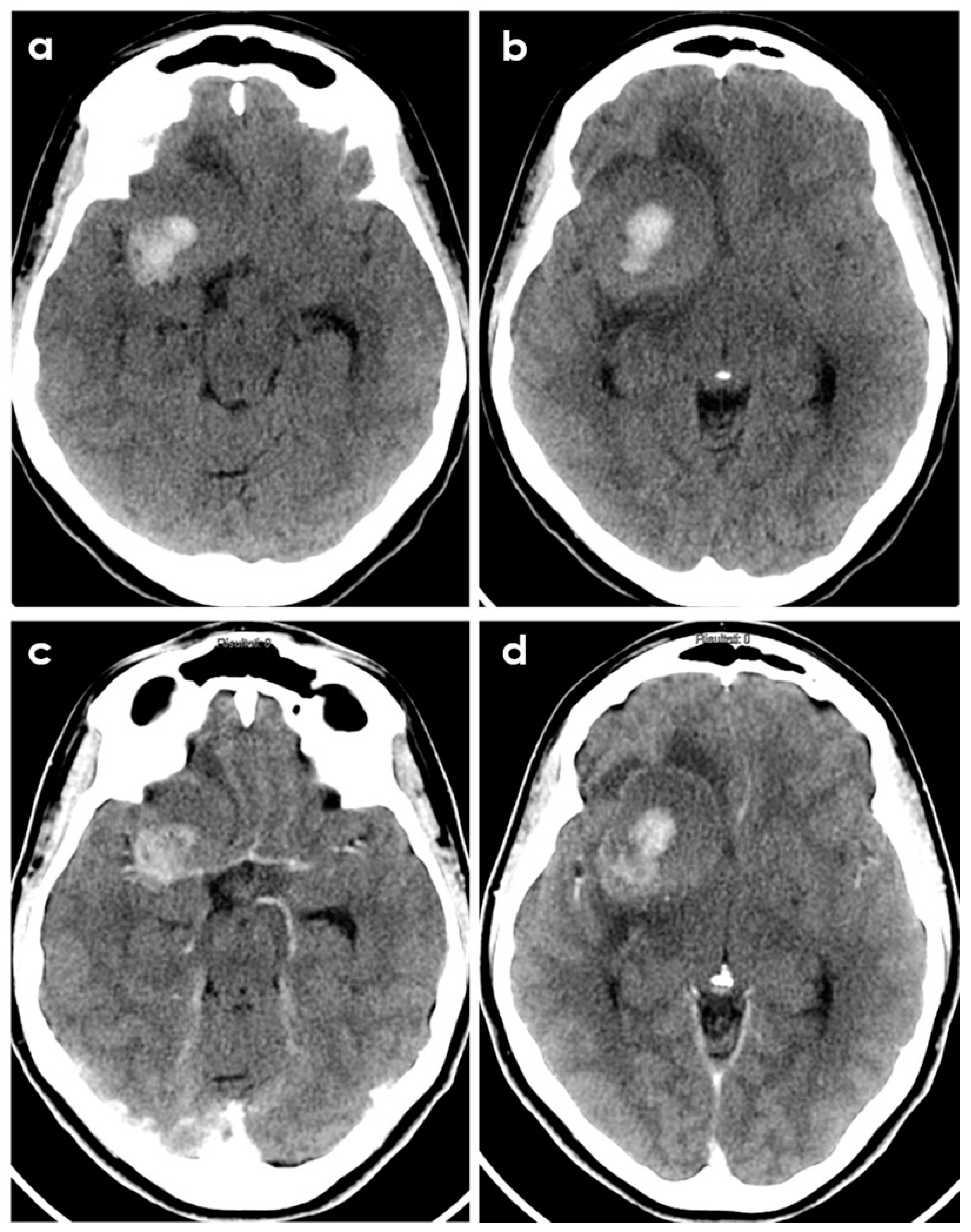 Biomedicines 12 00459 g002