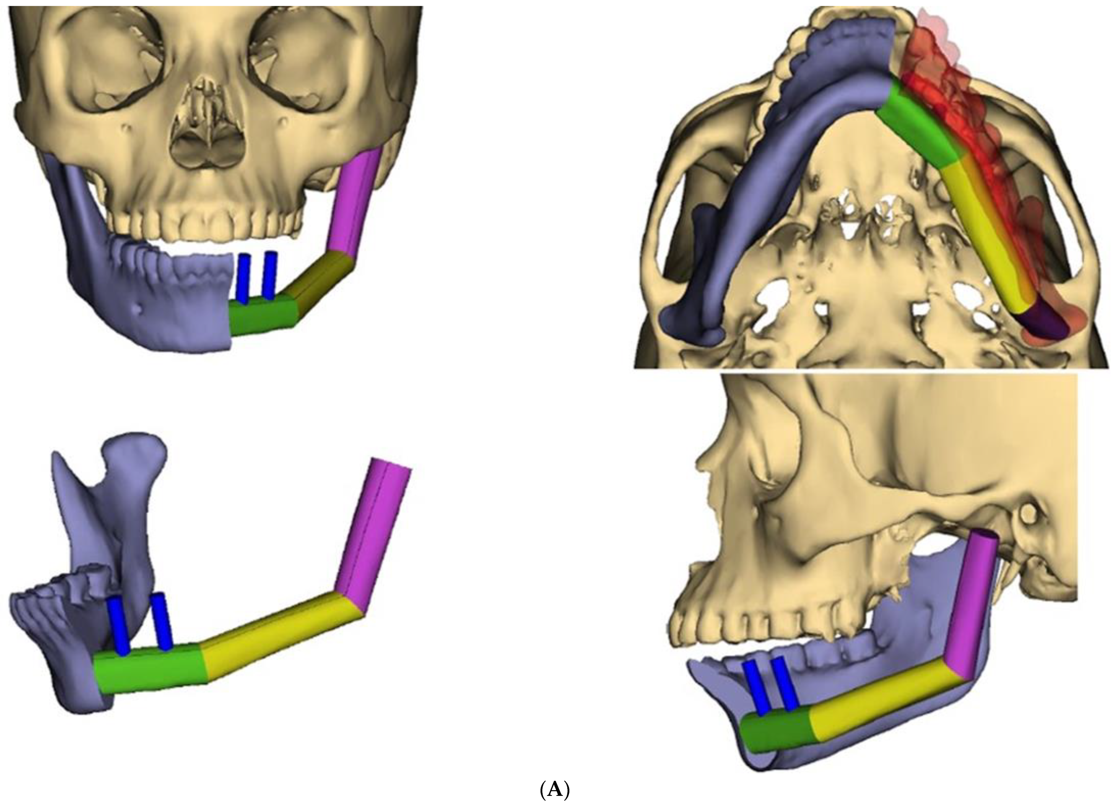 Biomedicines 12 00615 g006a