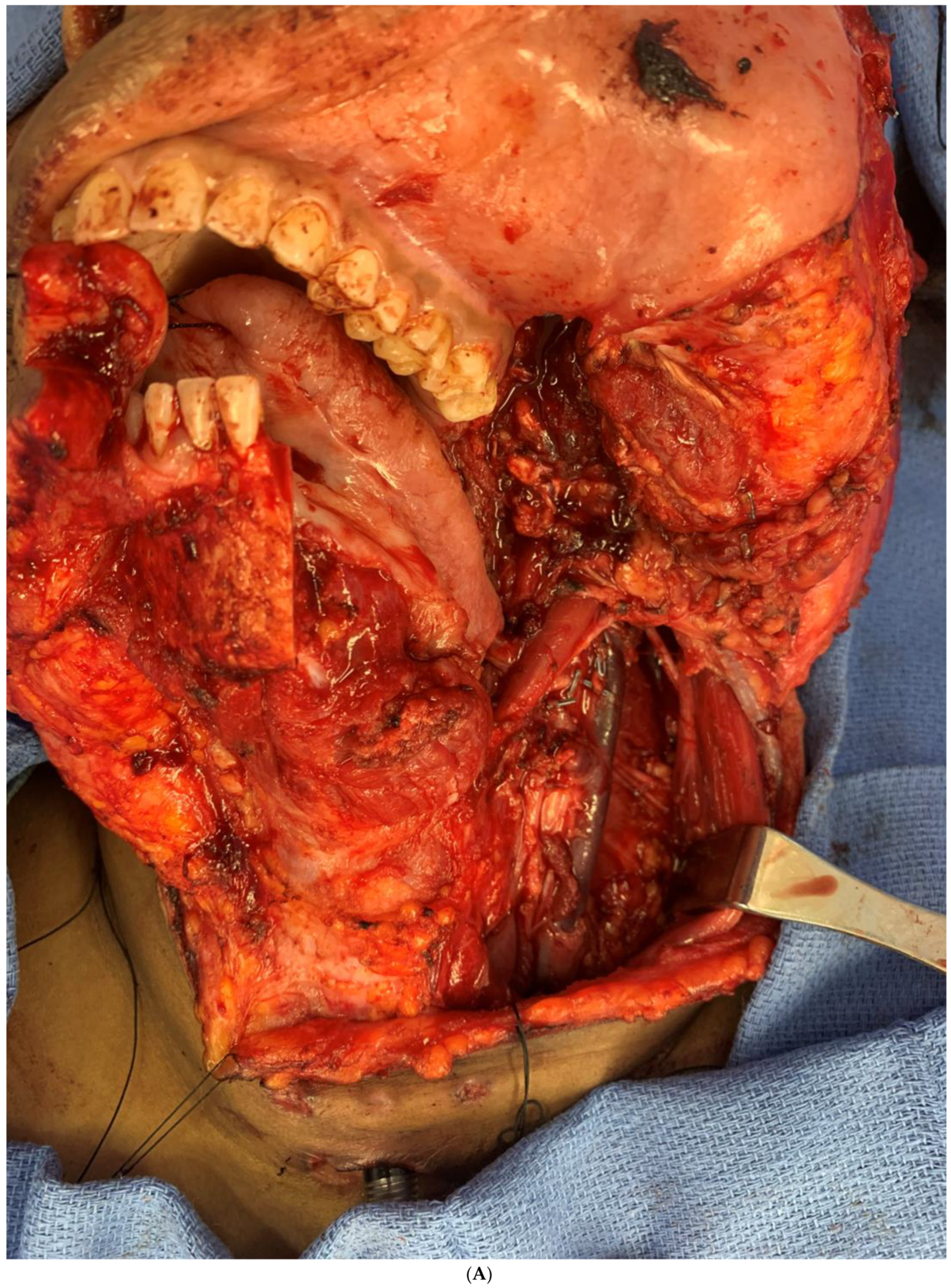 Biomedicines 12 00615 g007a