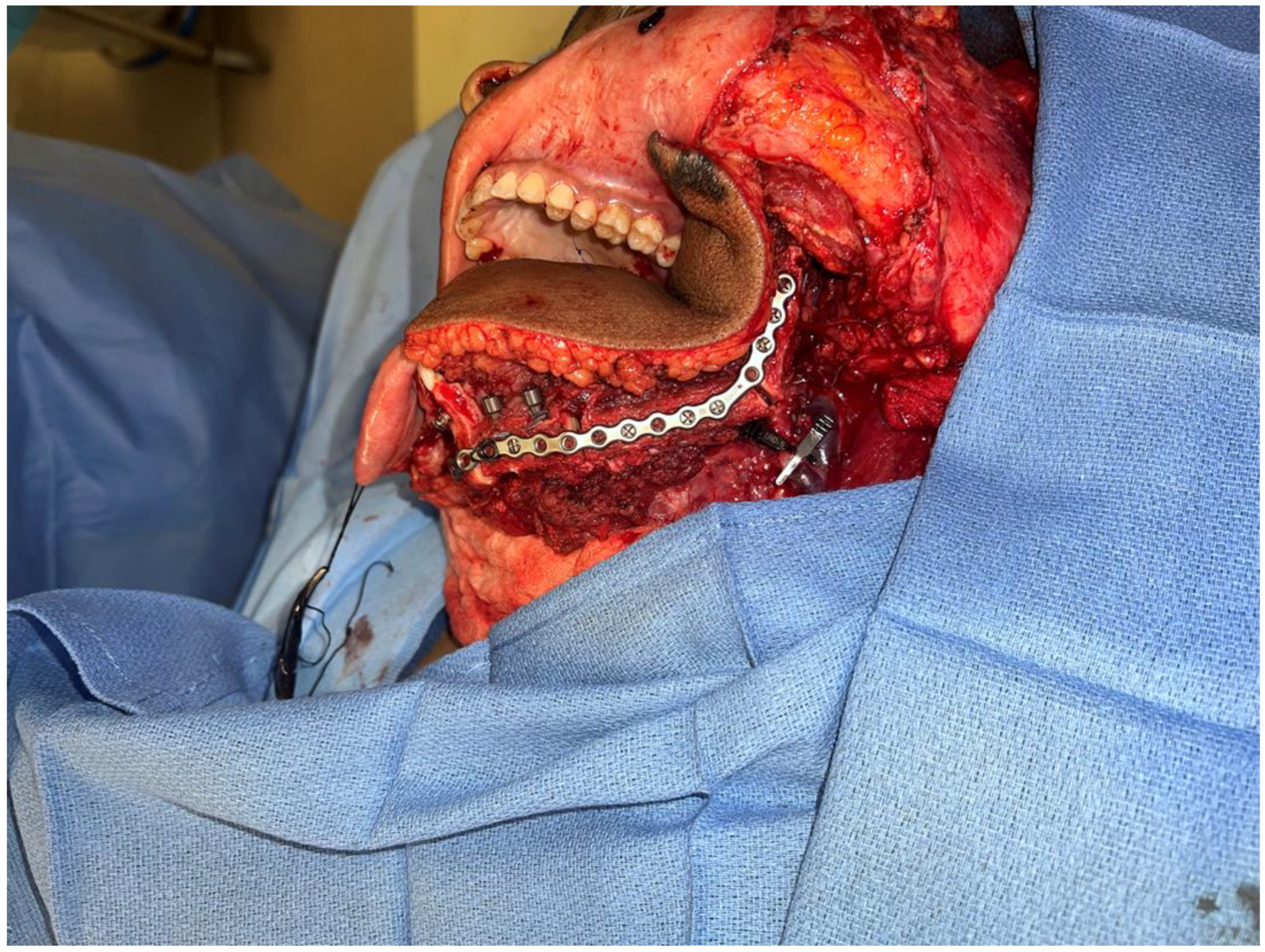 Biomedicines 12 00615 g008