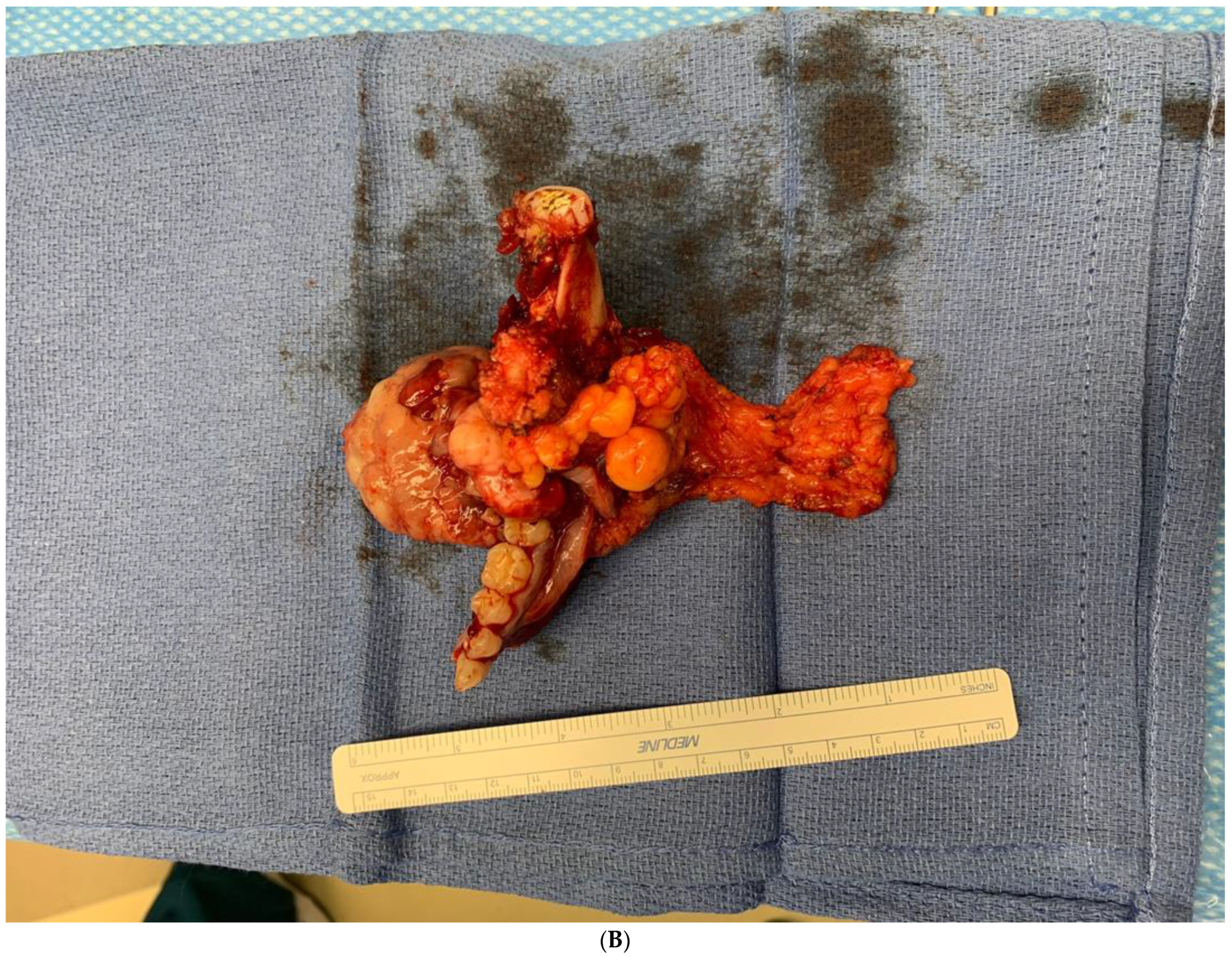 Biomedicines 12 00615 g009b