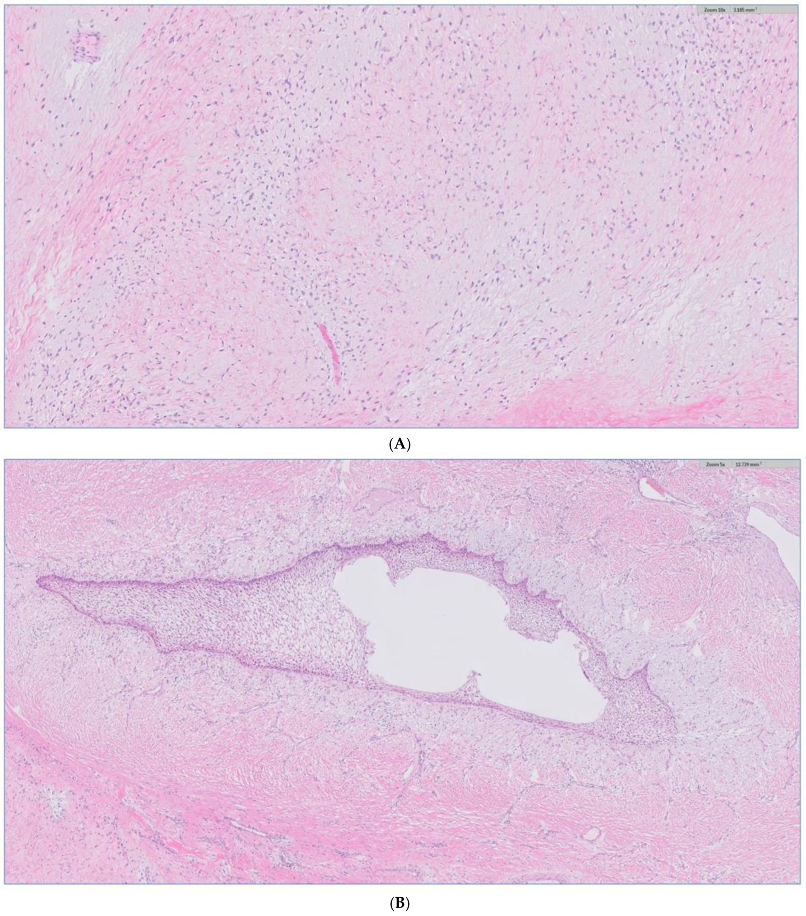Biomedicines 12 00615 g010a