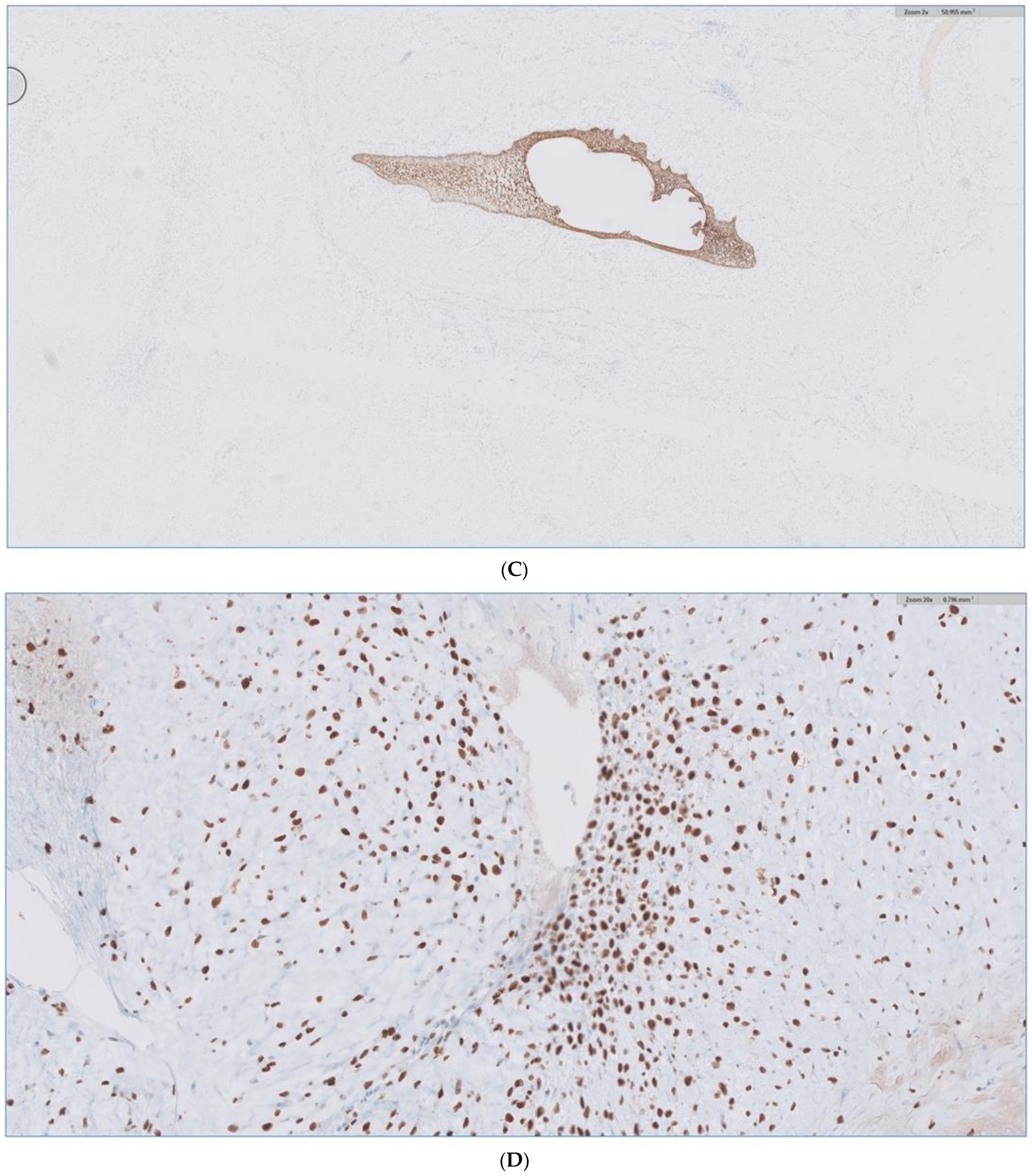 Biomedicines 12 00615 g010b