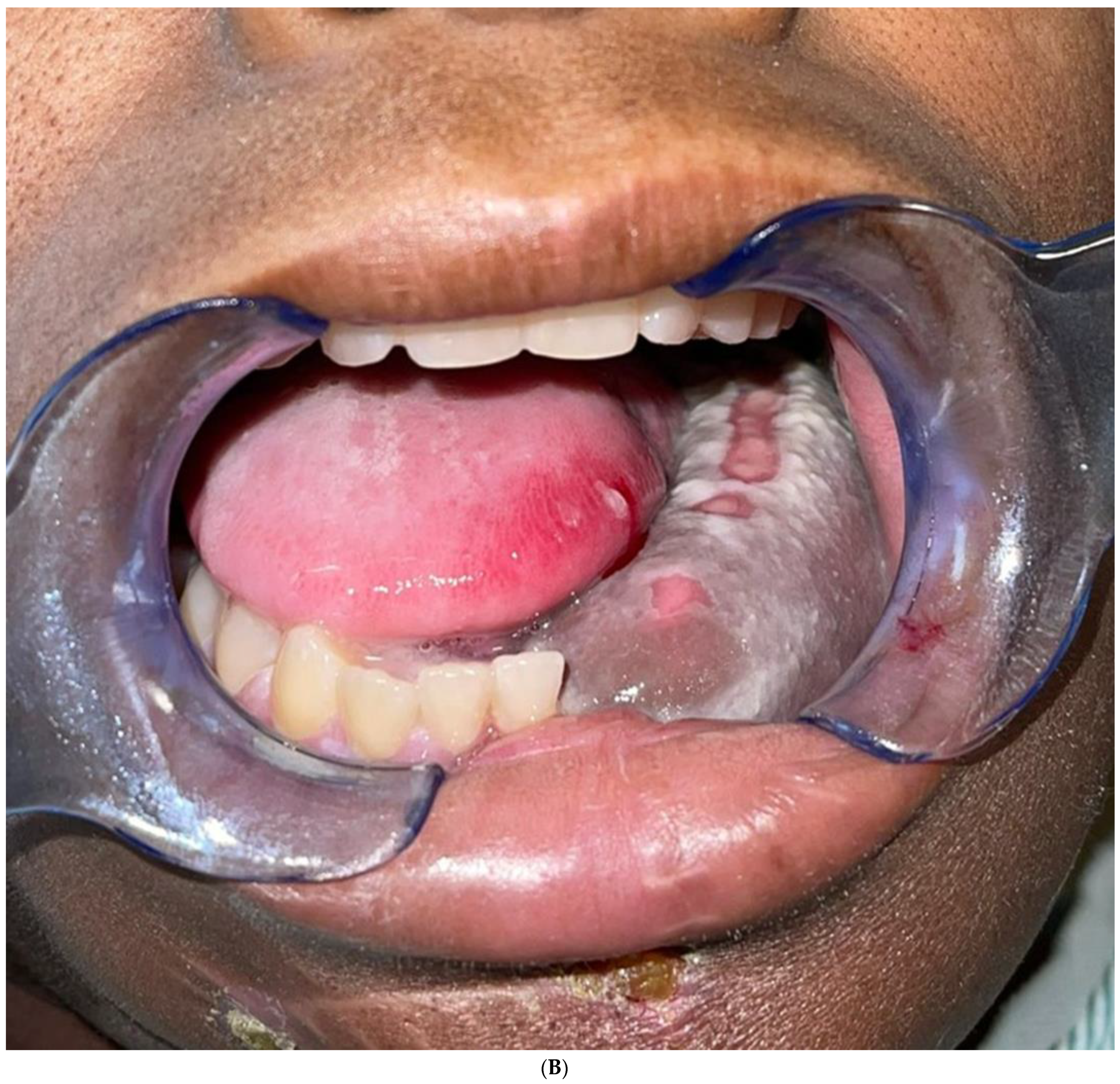 Biomedicines 12 00615 g011b