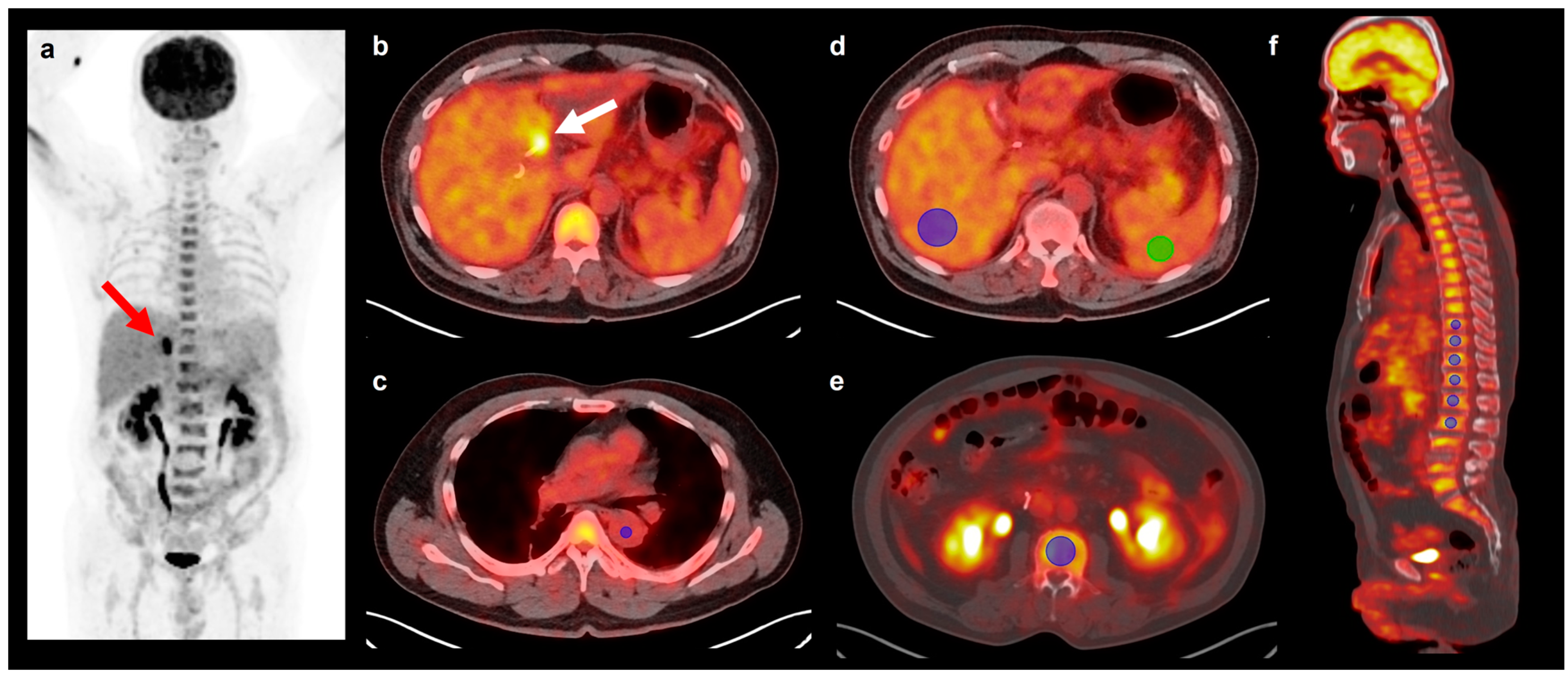 Biomedicines 12 00944 g001