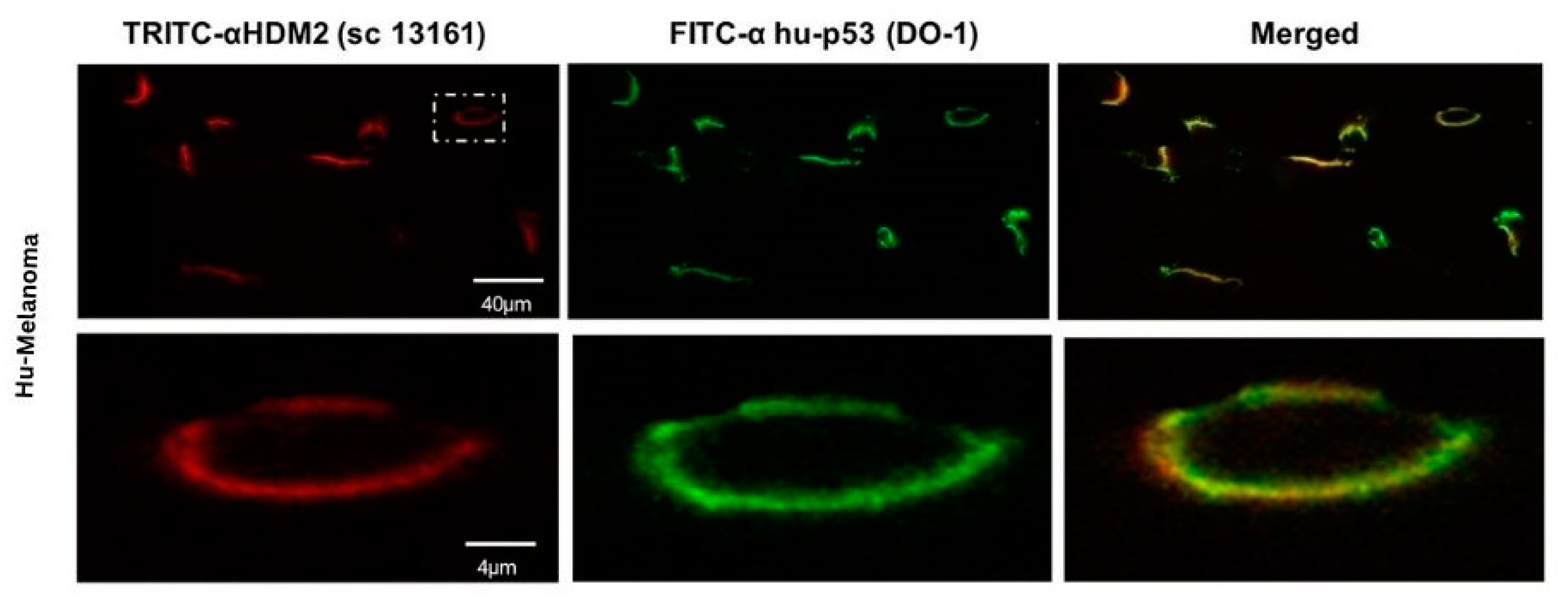 Biomedicines 12 01144 g004