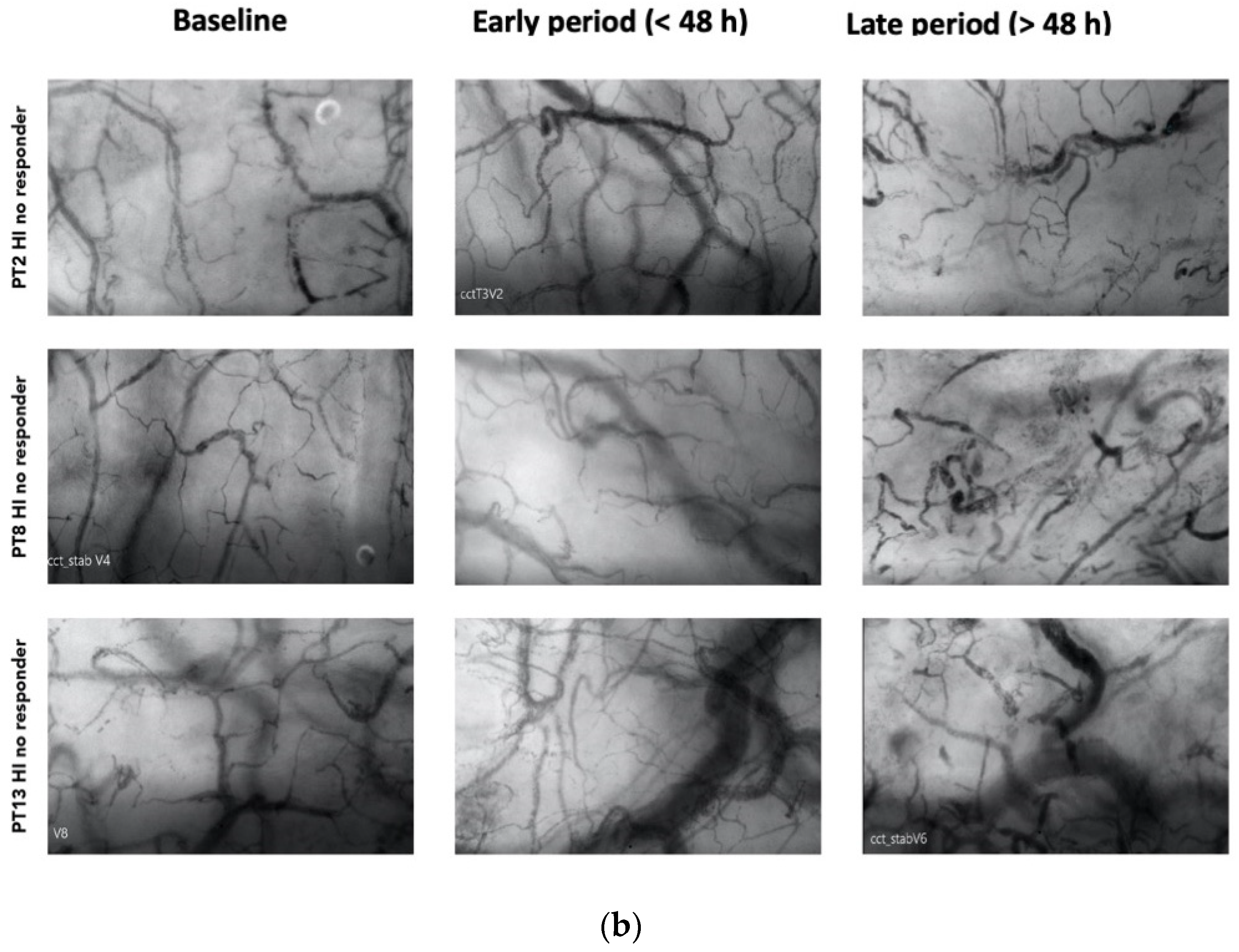 Biomedicines 12 01435 g002b