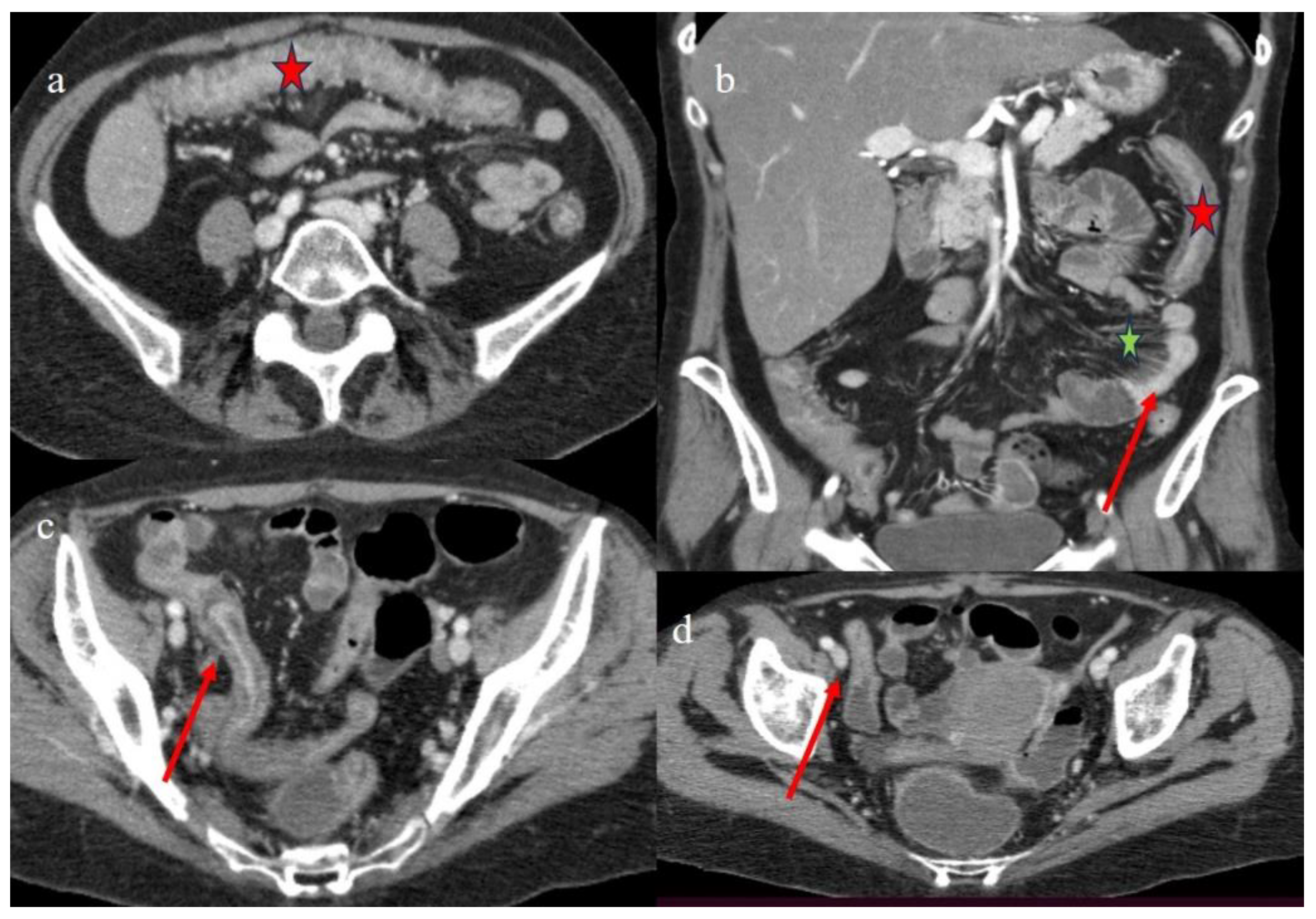 Biomedicines 12 01516 g003
