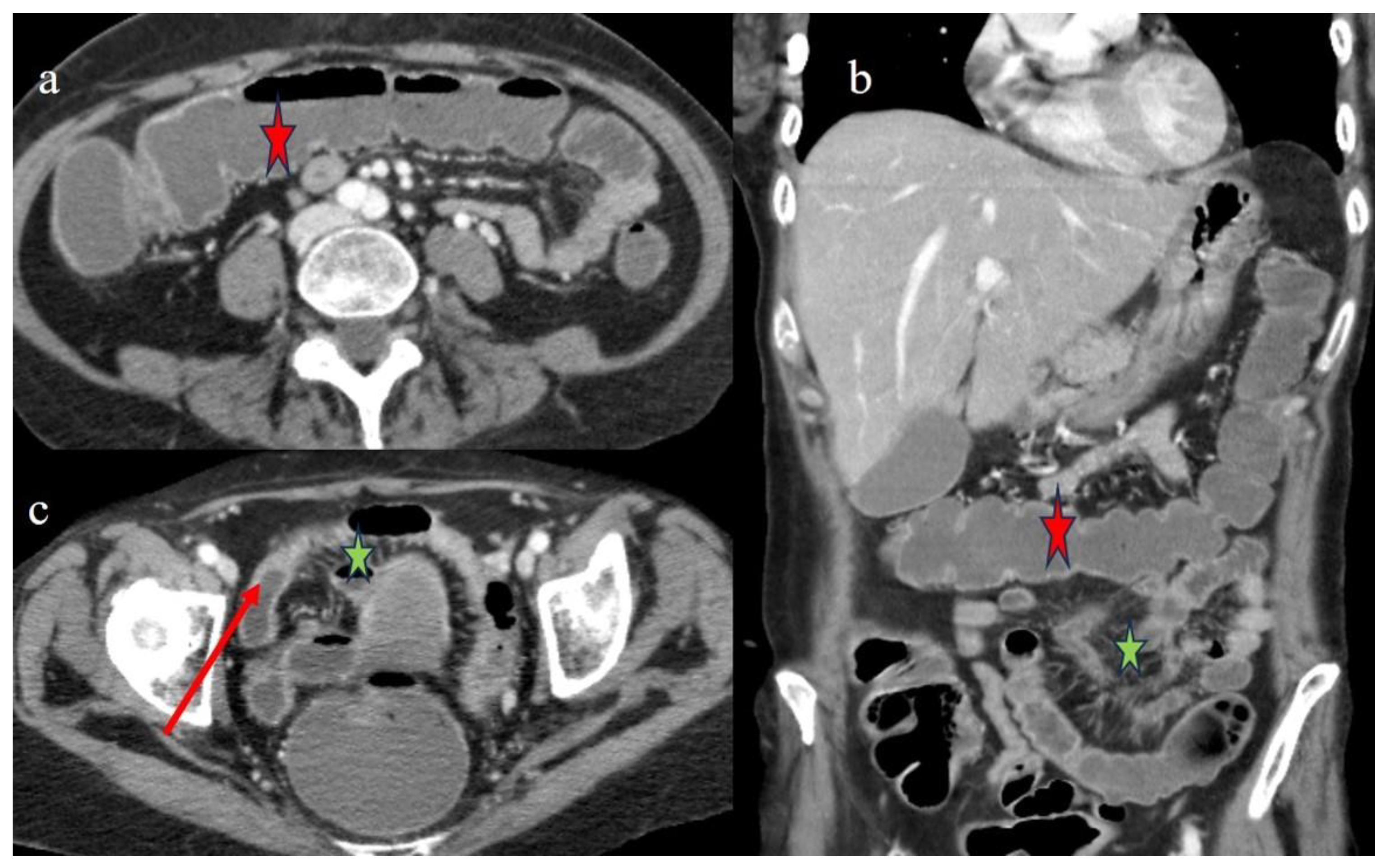 Biomedicines 12 01516 g004