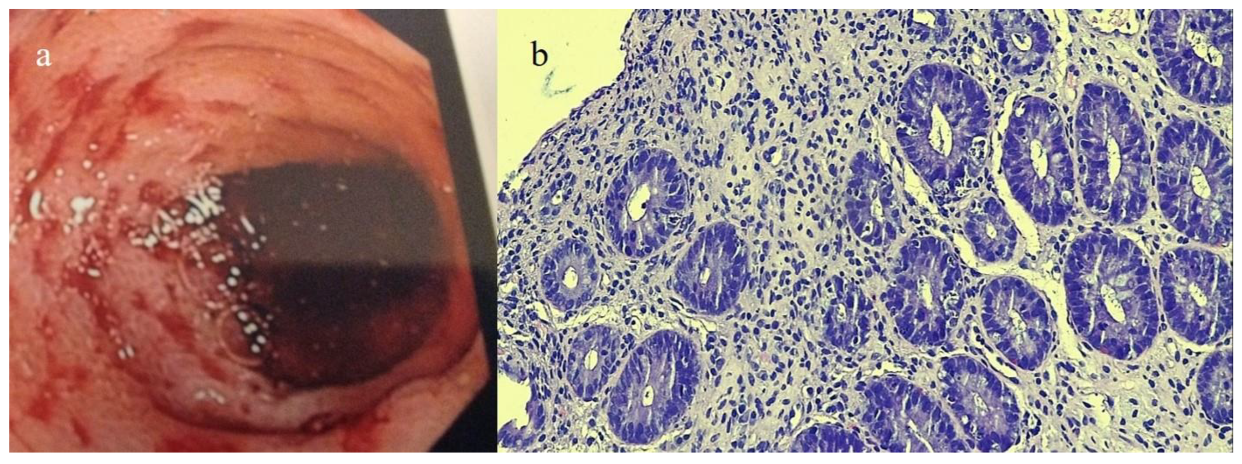 Biomedicines 12 01516 g005