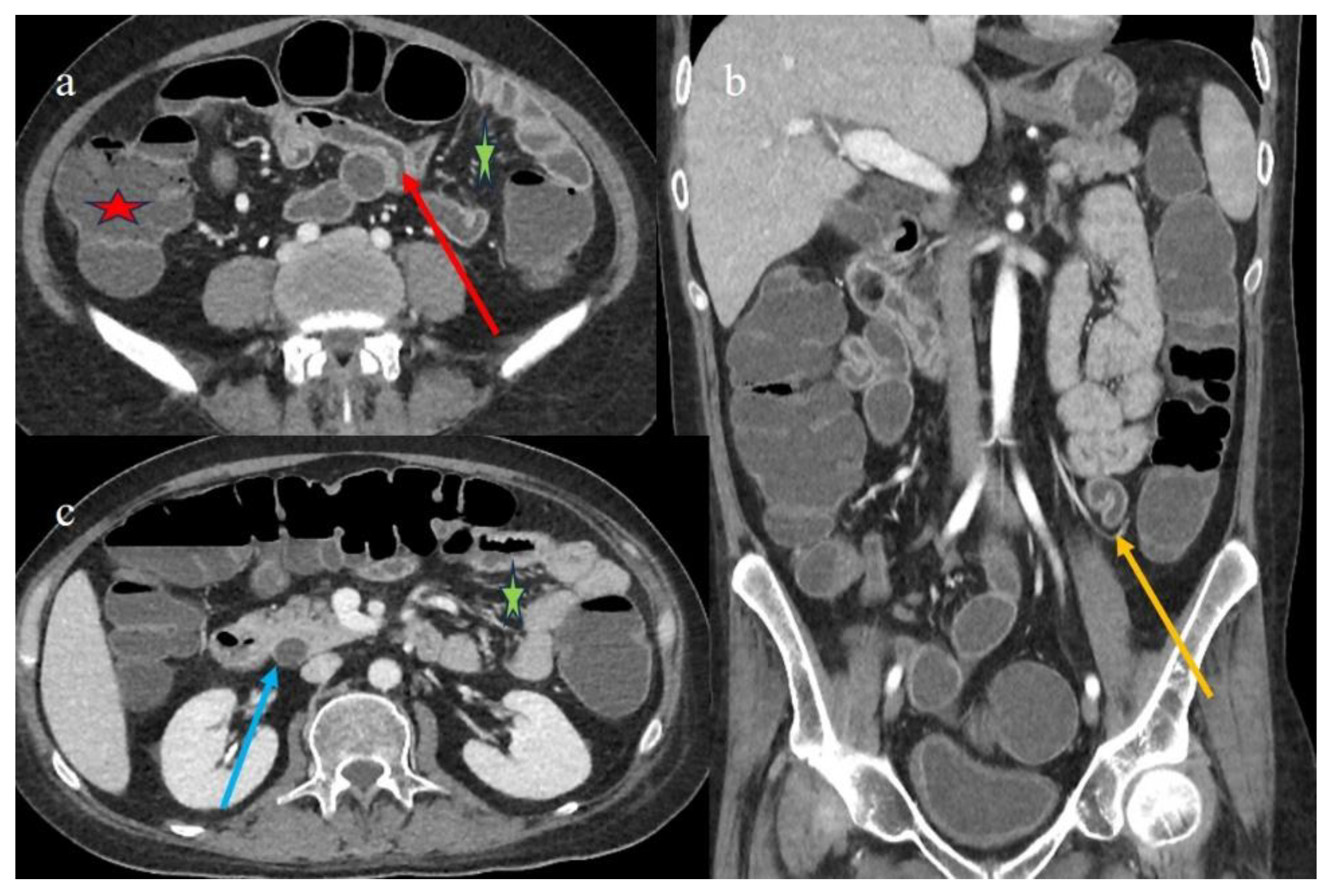 Biomedicines 12 01516 g006