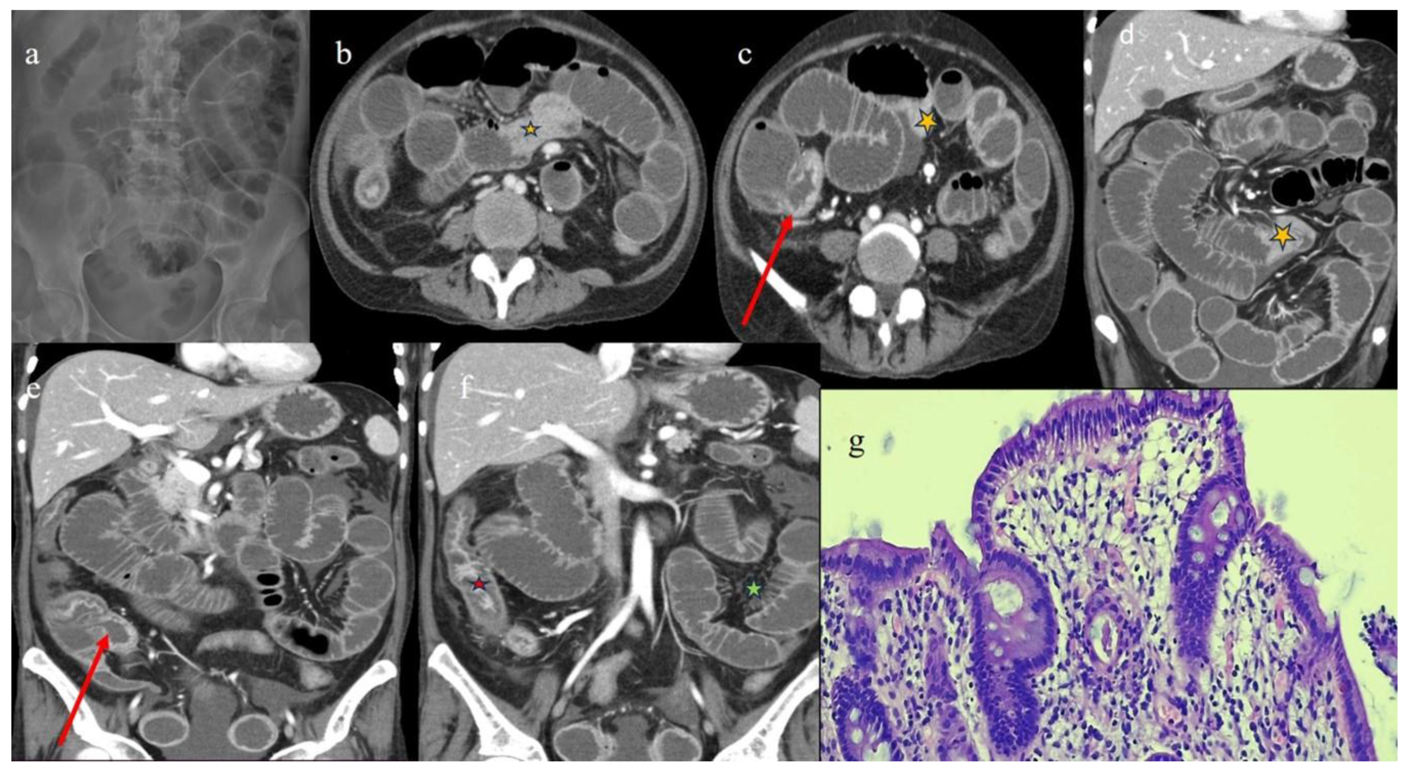 Biomedicines 12 01516 g010