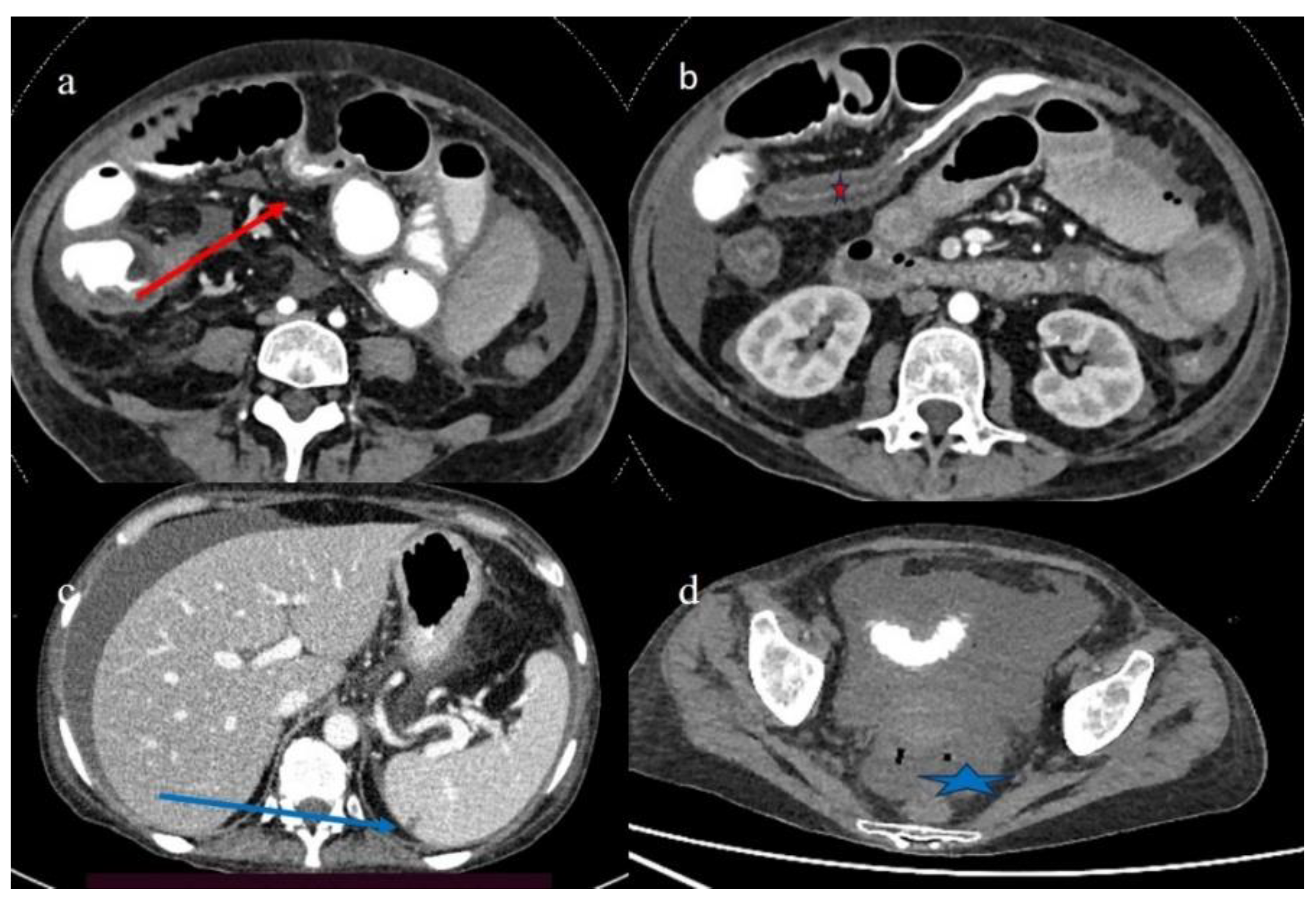 Biomedicines 12 01516 g011