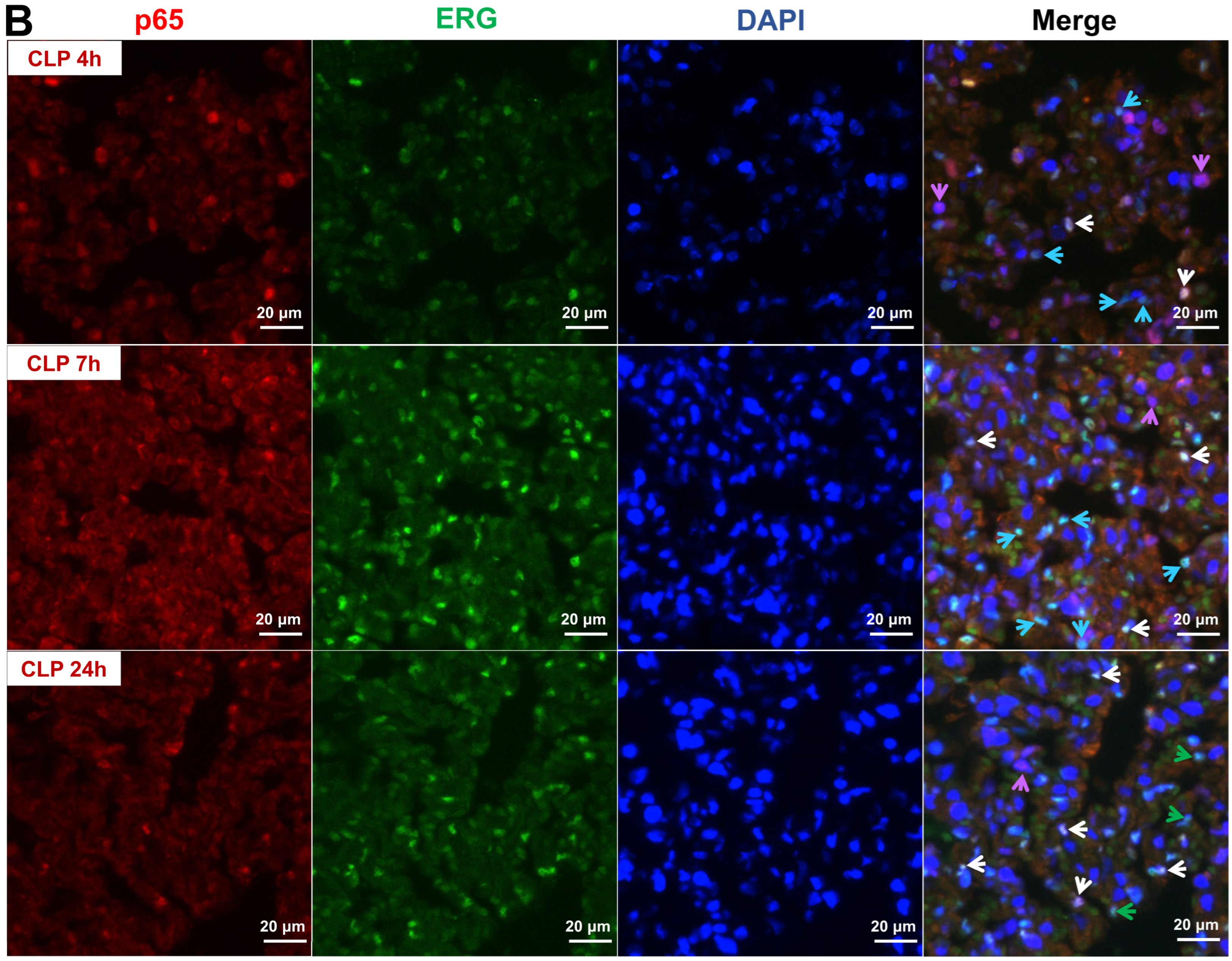 Biomedicines 12 01672 g002b