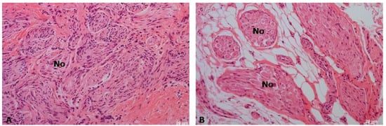 Biomedicines 12 01688 g008