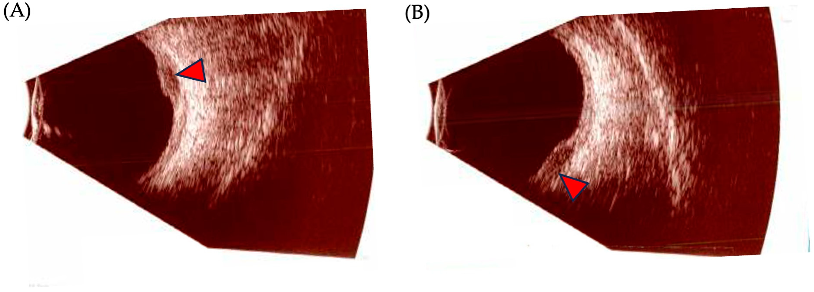 Biomedicines 12 01758 g004
