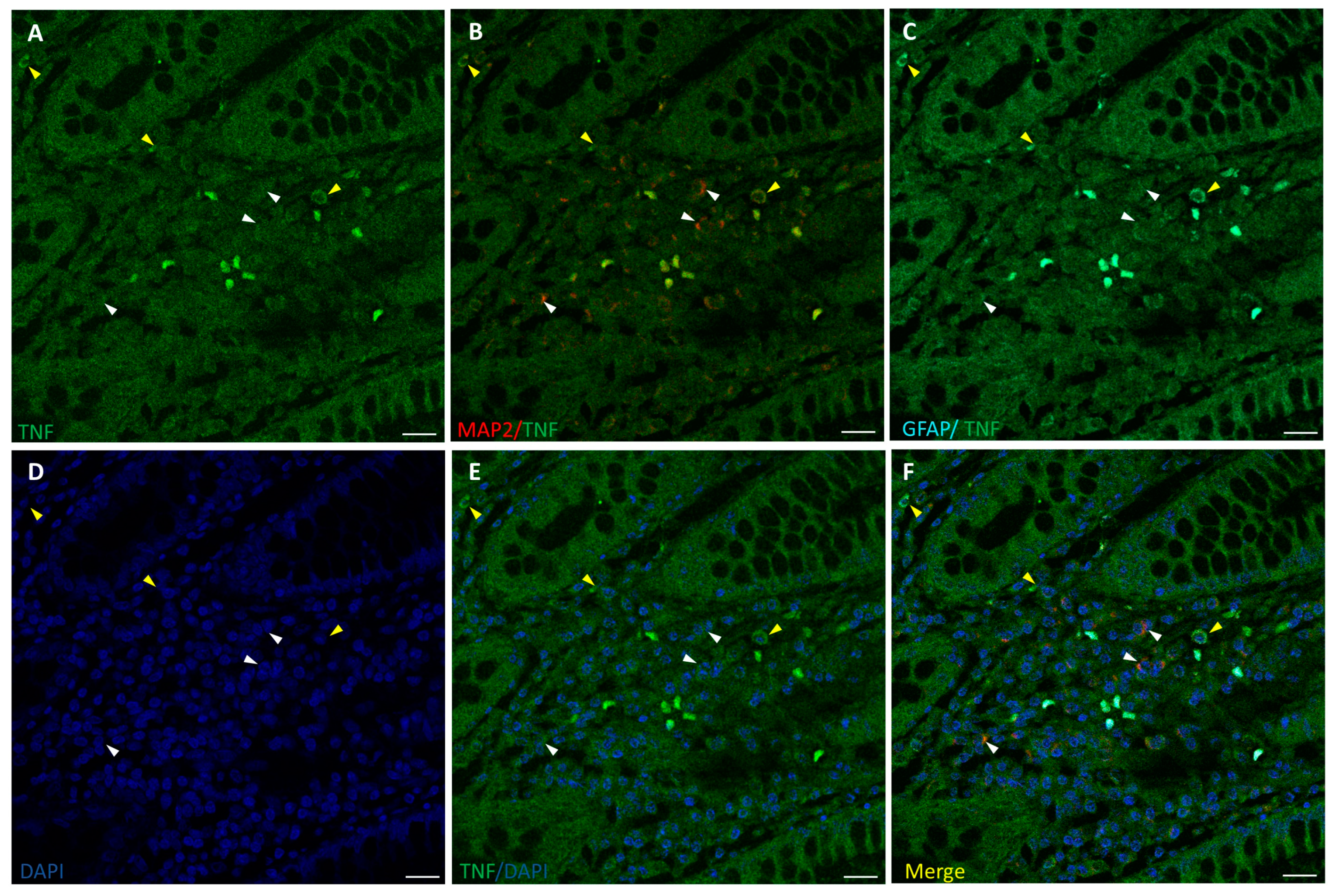 Biomedicines 12 01952 g004