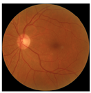 Biomedicines 12 02092 i003