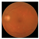 Biomedicines 12 02092 i005